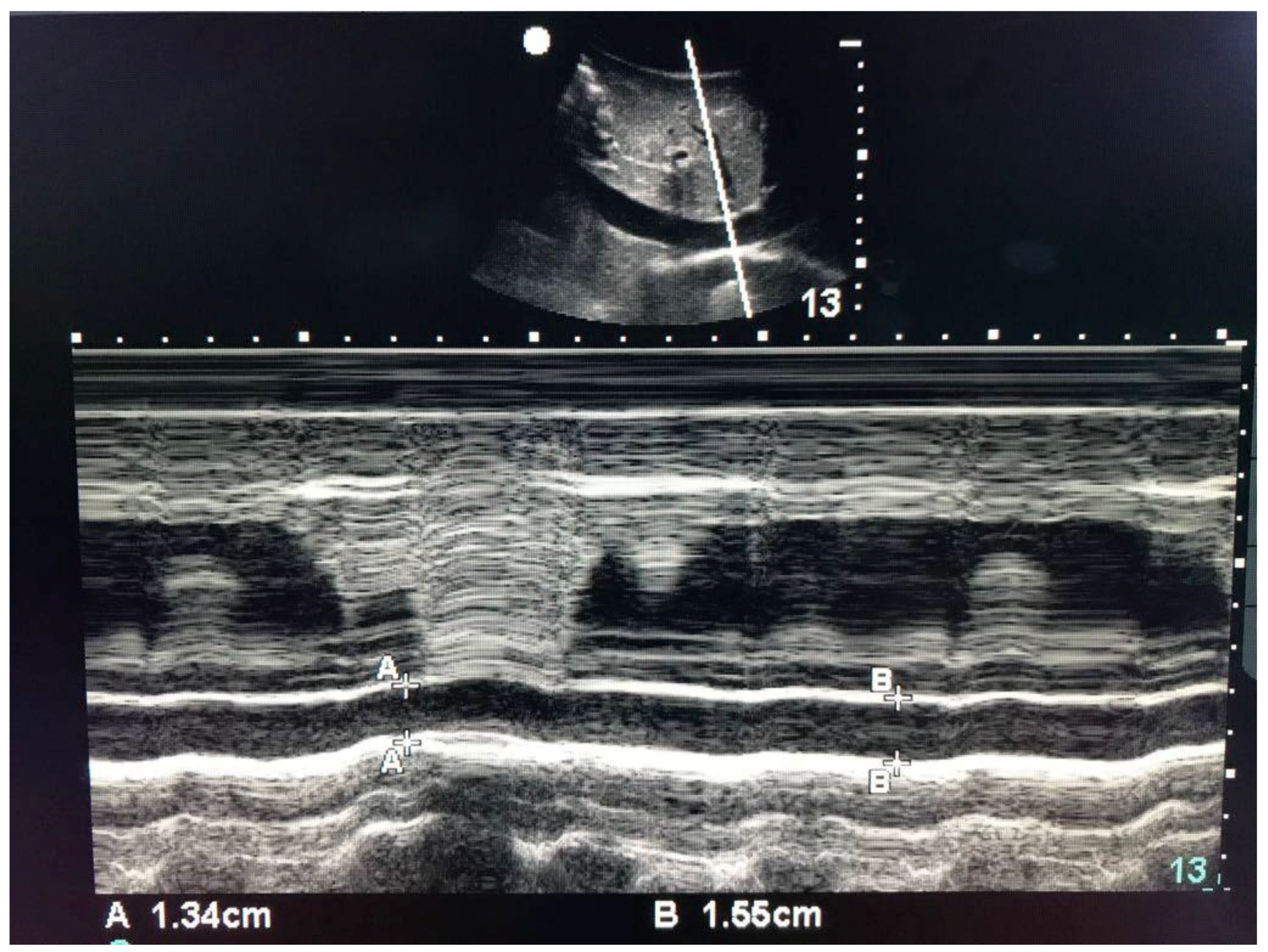 Jcm 07 00145 g002