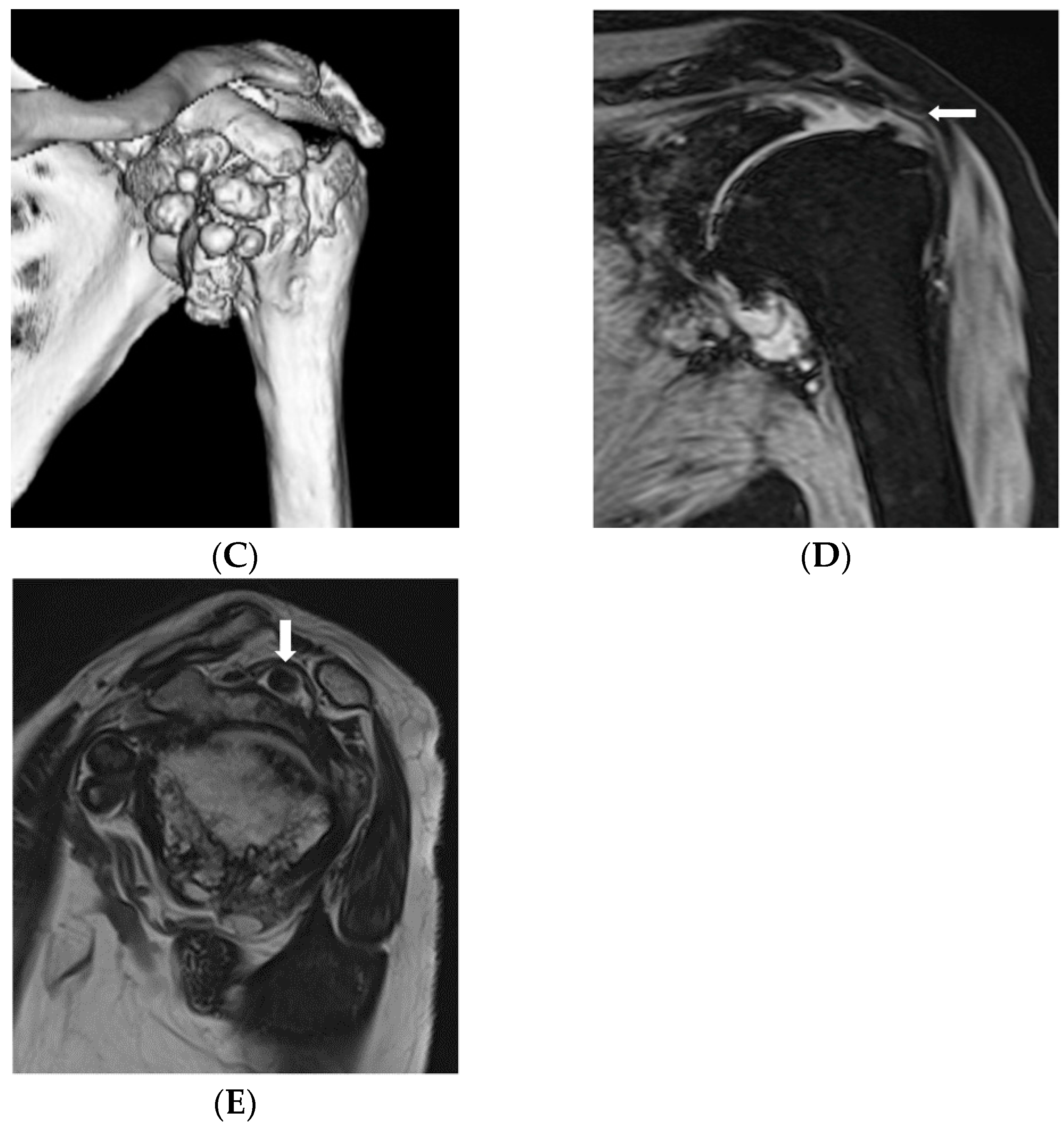 Jcm 07 00189 g001b Jcm 07 00189 g001b