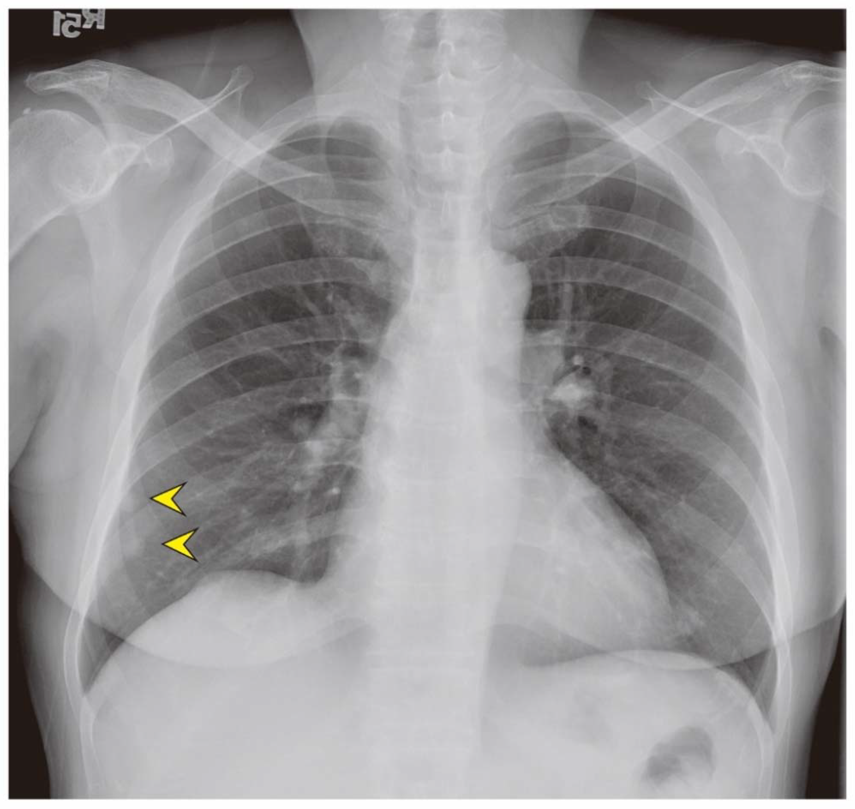 Jcm 07 00207 g002 Jcm 07 00207 g002