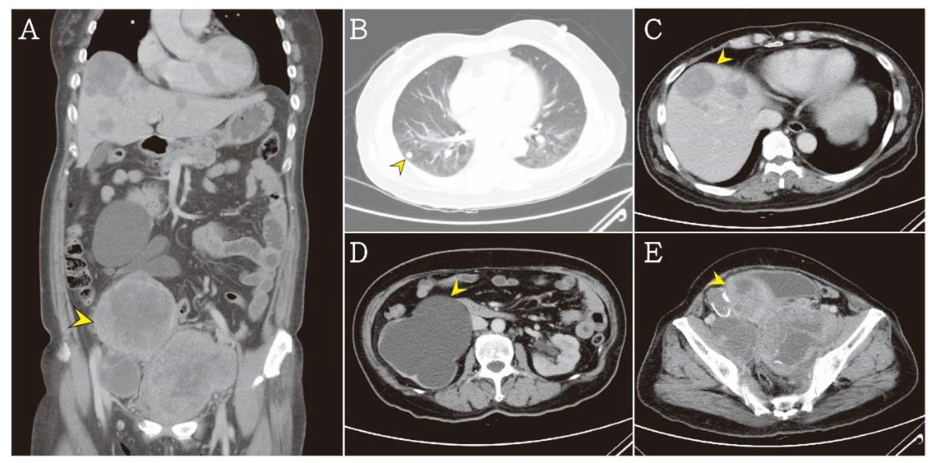 Jcm 07 00207 g003 Jcm 07 00207 g003