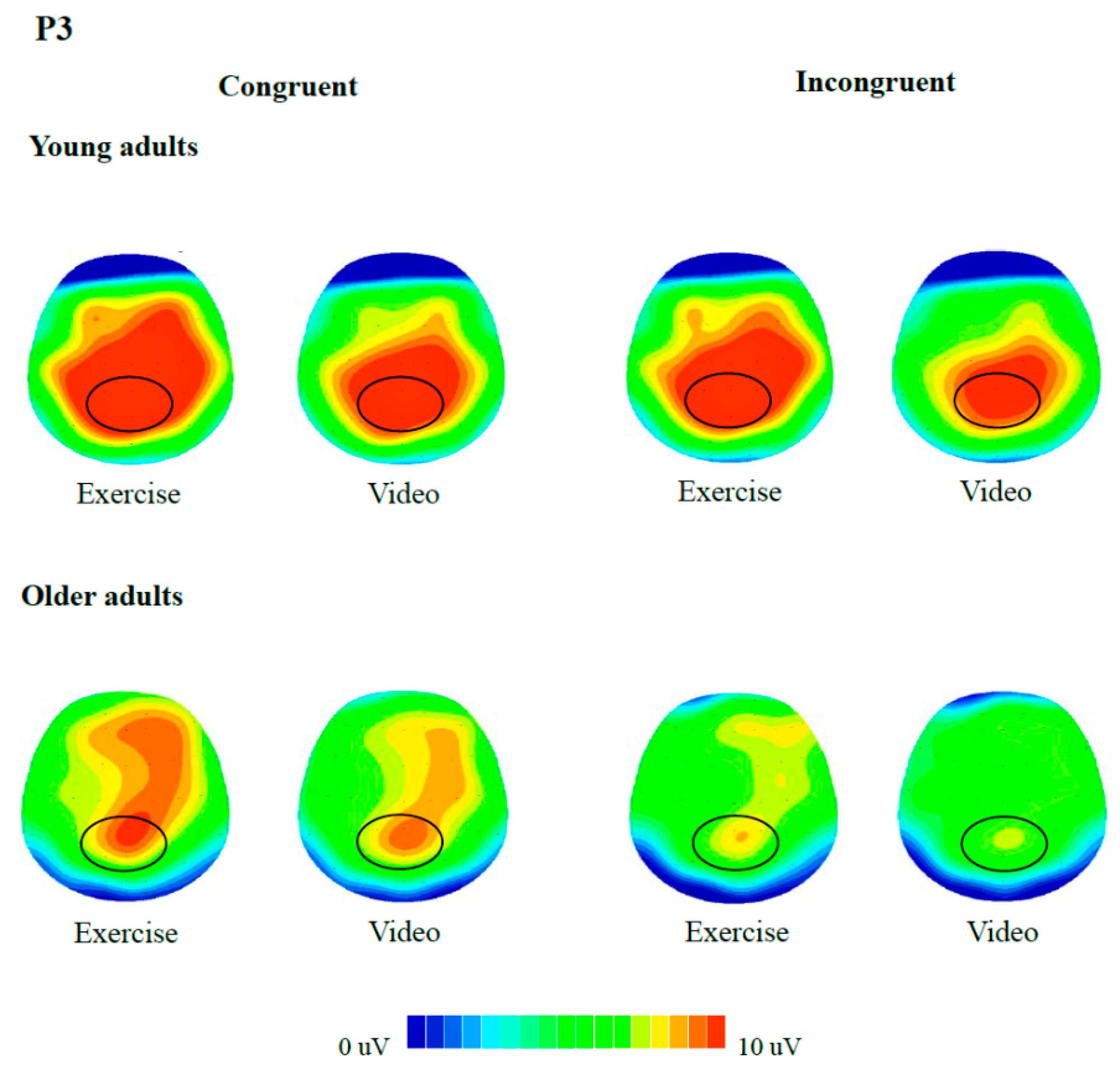 Acute Exercise Facilitates the N450 Inhibition Marker and P3 Attention  Marker during Stroop Test in Young and Older Adults