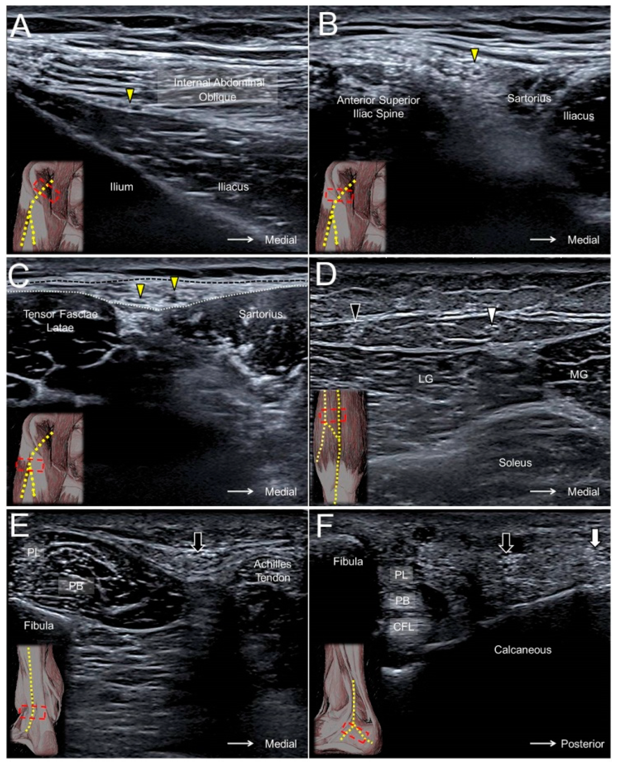 JCM | Free Full-Text | Ultrasound Imaging for the Cutaneous Nerves of