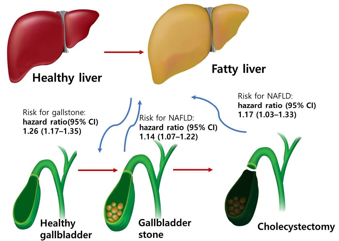 Elevated Liver Enzymes After Gallbladder Removal Liver Enzymes With Gallbladder Disease at Brooke Way blog