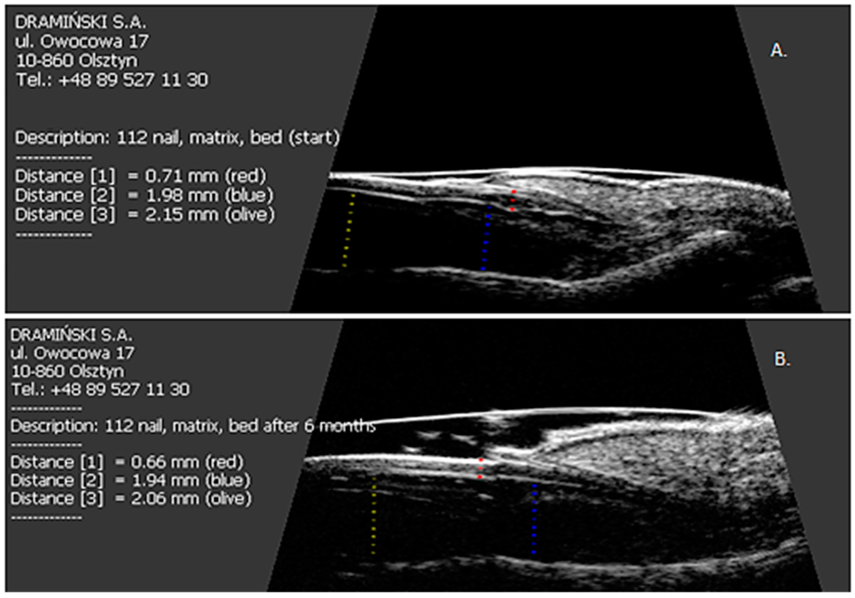 Jcm 07 00546 g003 Jcm 07 00546 g003