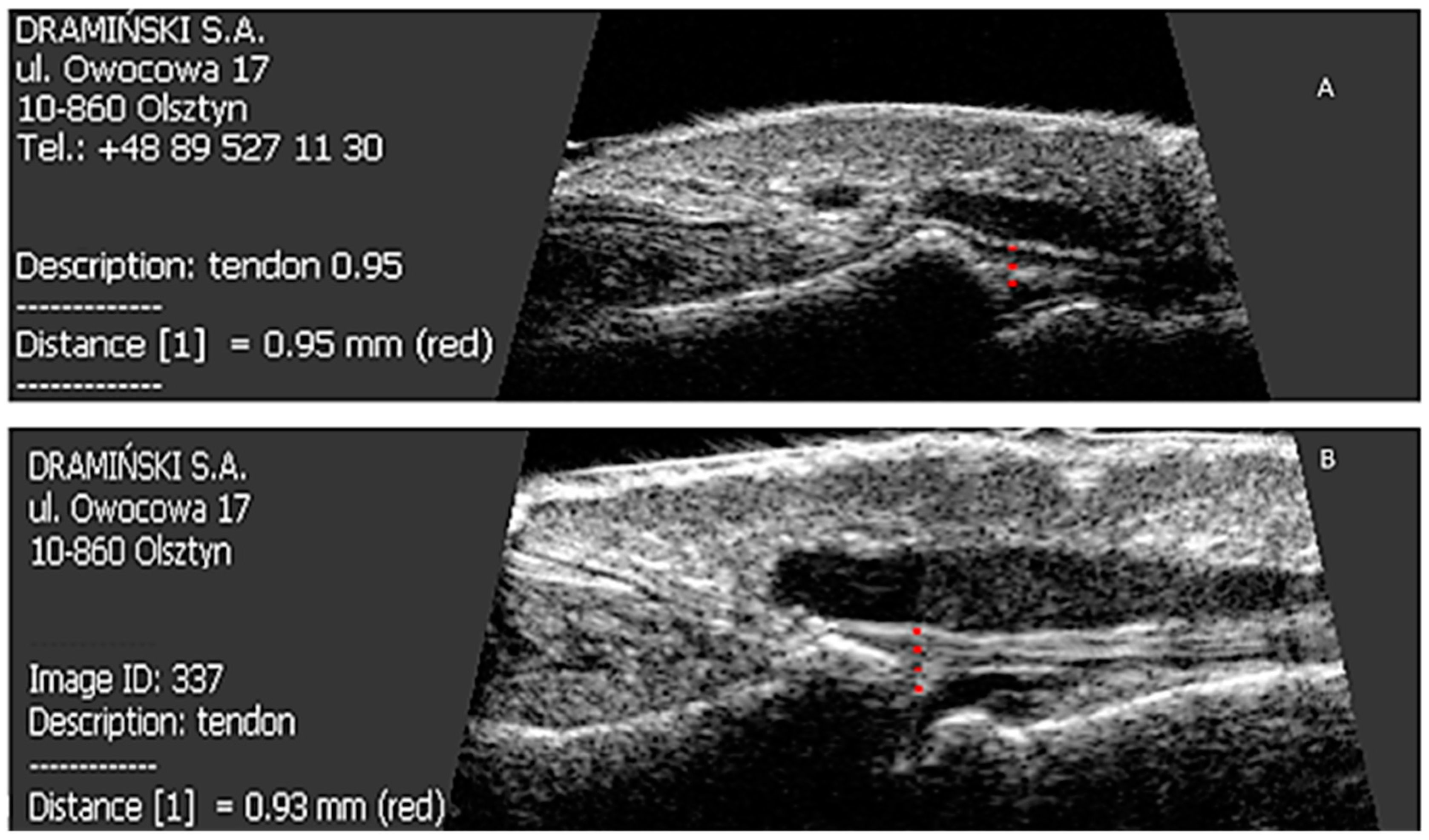 Jcm 07 00546 g004 Jcm 07 00546 g004