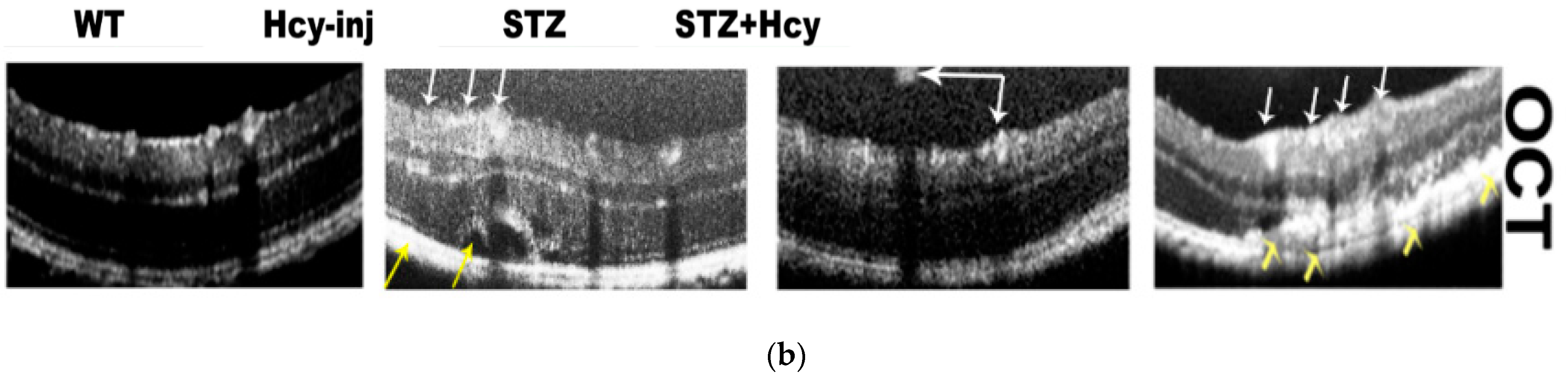 Jcm 08 00121 g004b Jcm 08 00121 g004b