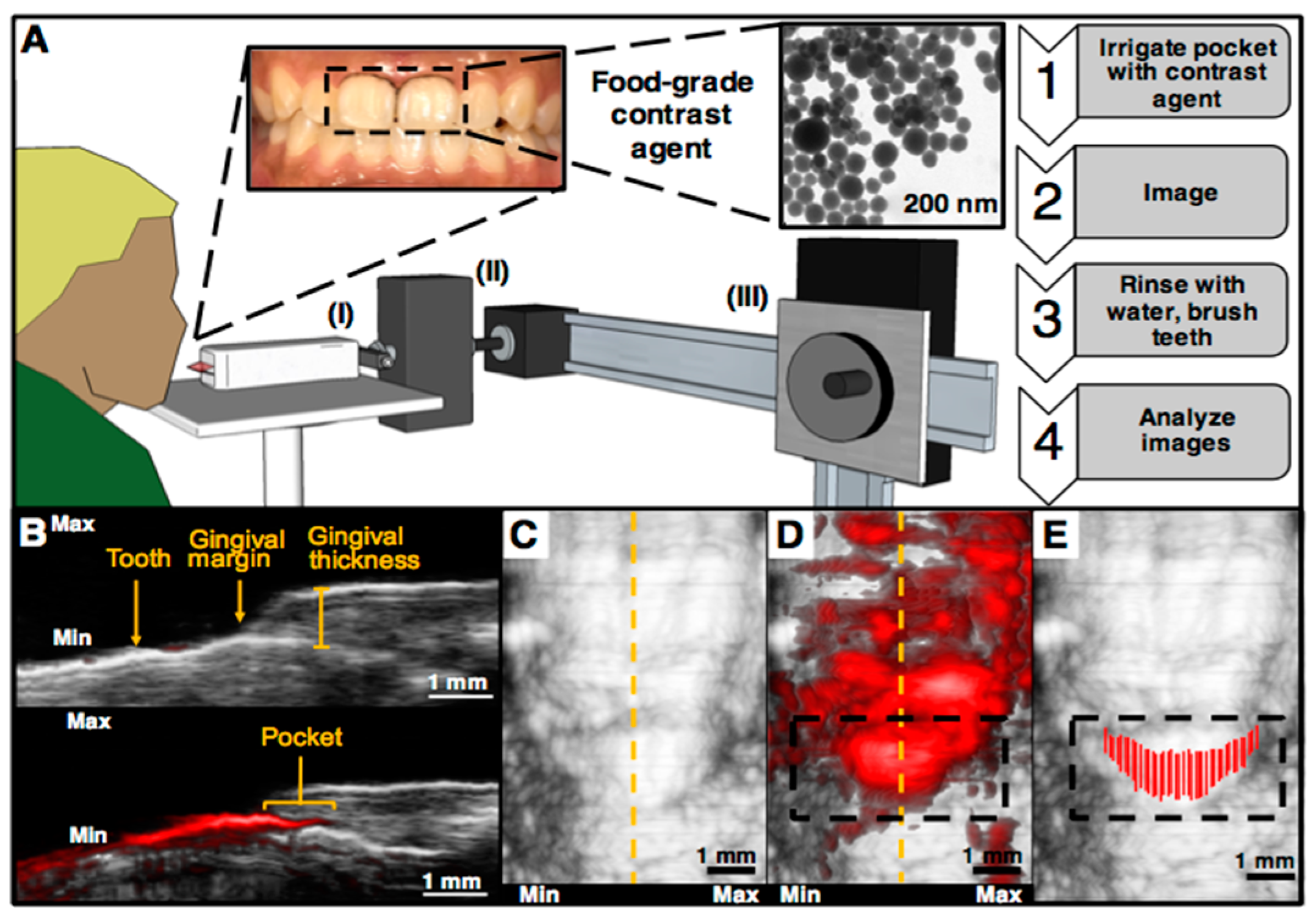 Jcm 08 00166 g004 Jcm 08 00166 g004