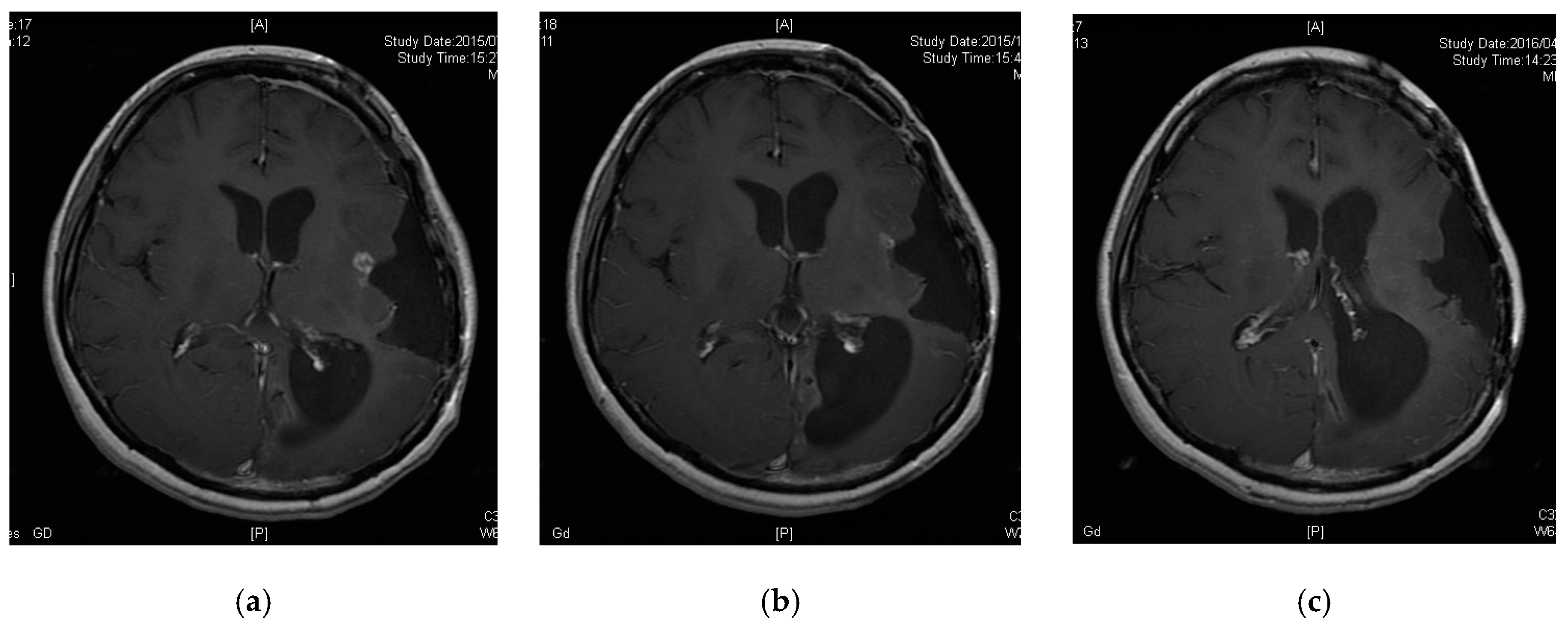 Jcm 08 00263 g002 Jcm 08 00263 g002