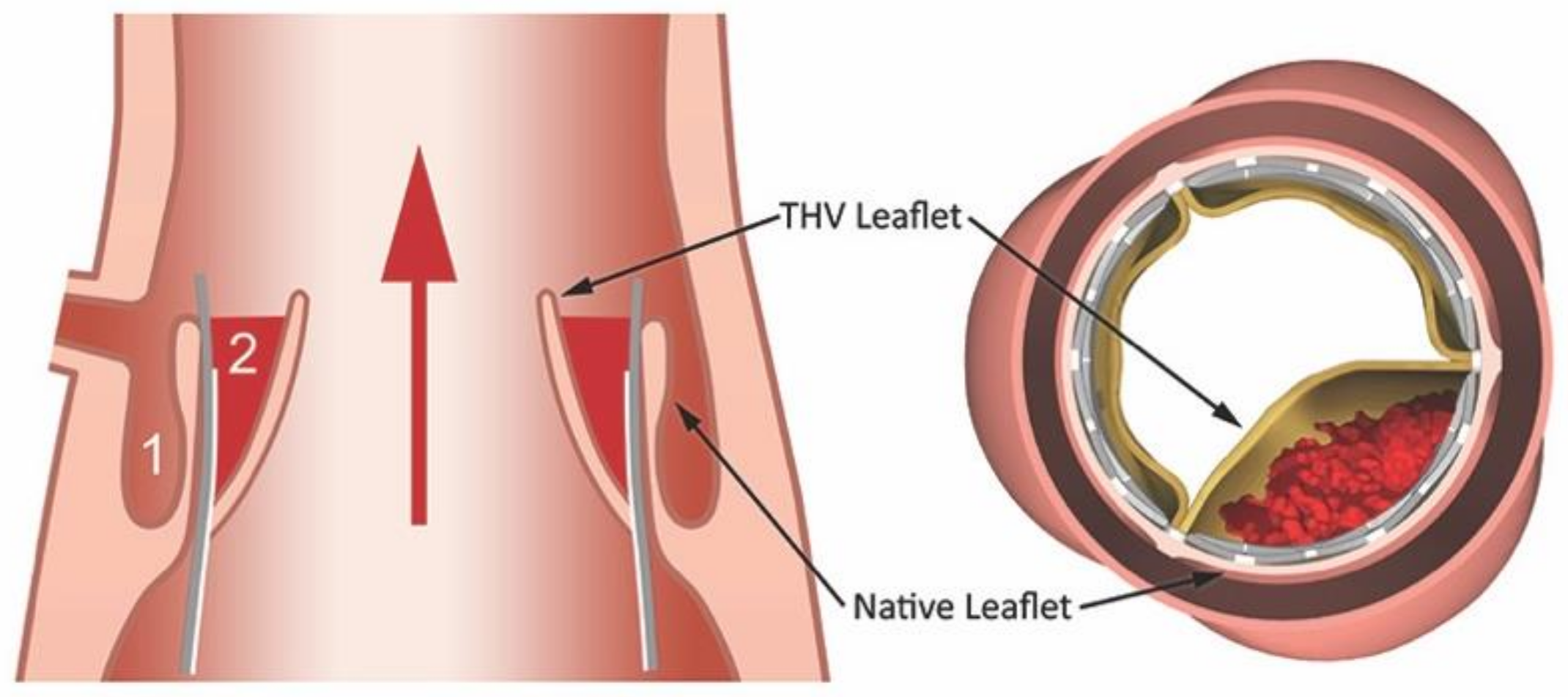 Jcm 08 00280 g001 Jcm 08 00280 g001