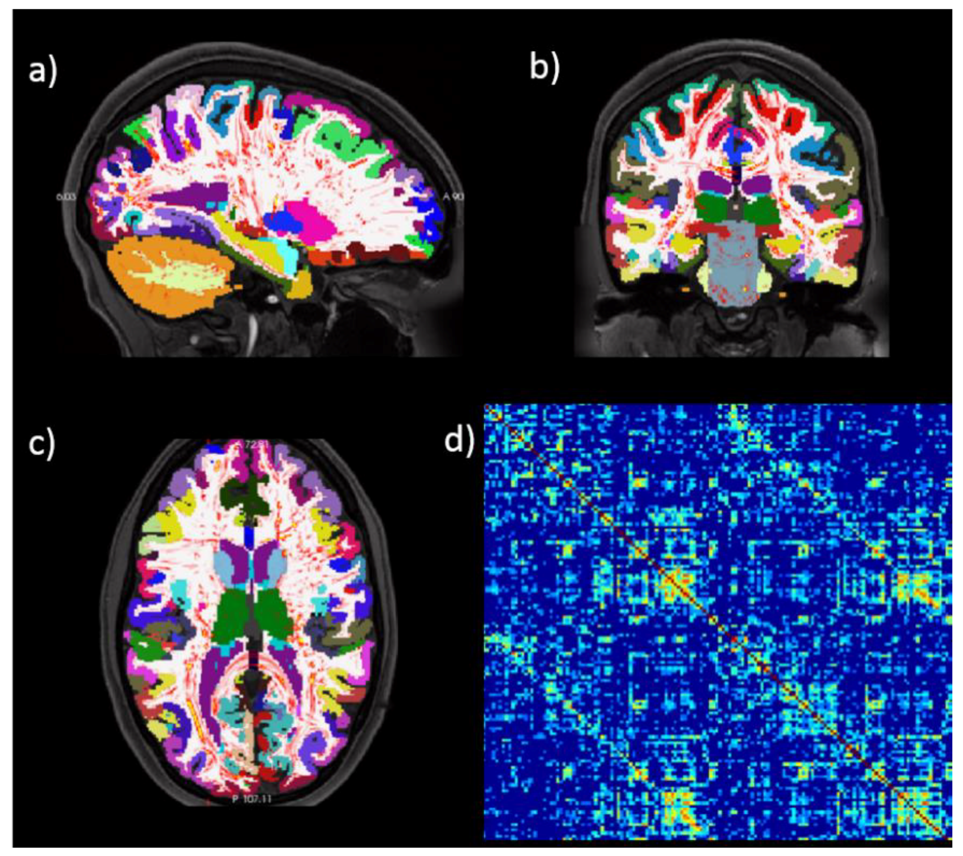 Jcm 08 00316 g003 Jcm 08 00316 g003