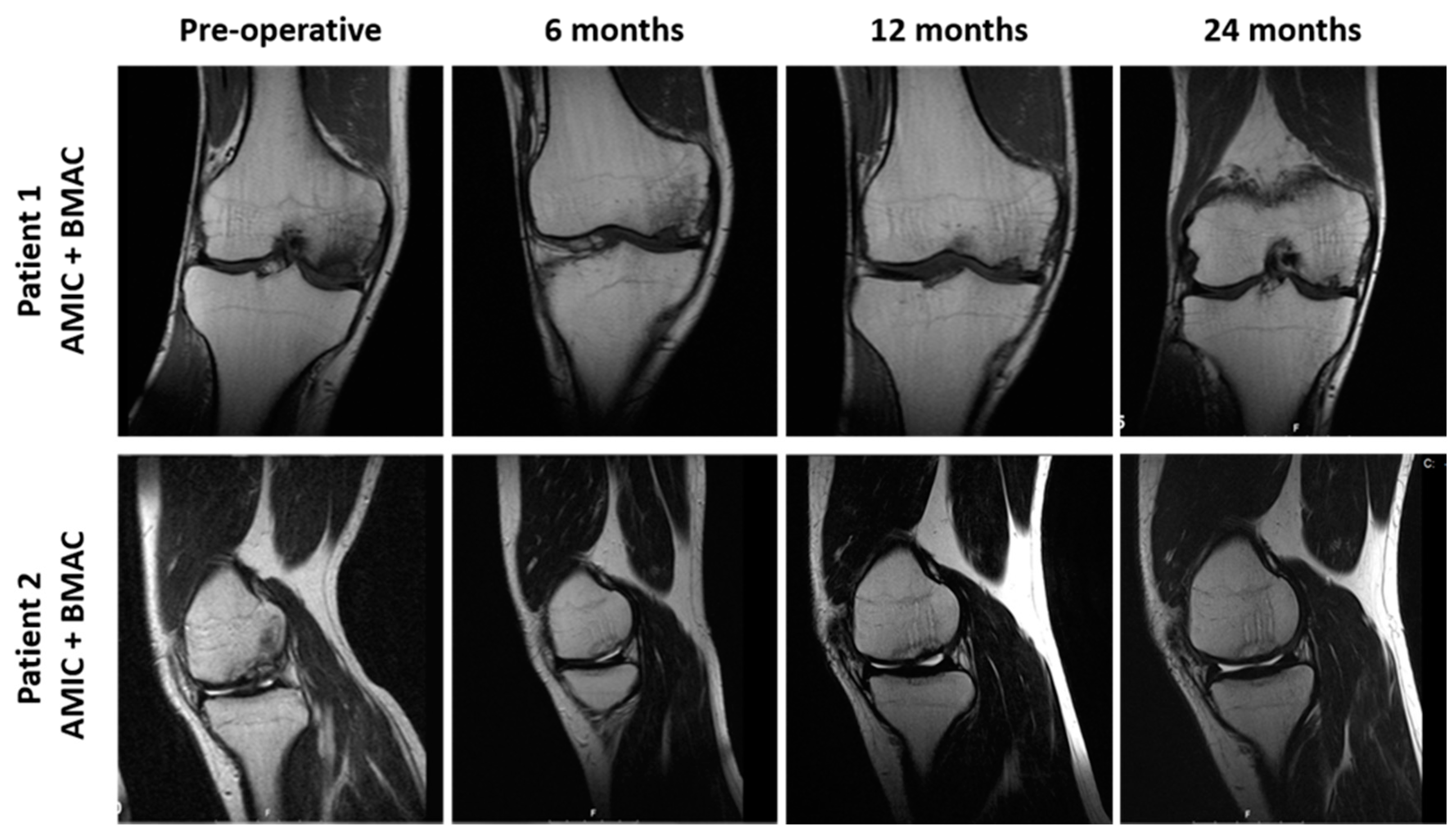 Jcm 08 00392 g007 Jcm 08 00392 g007