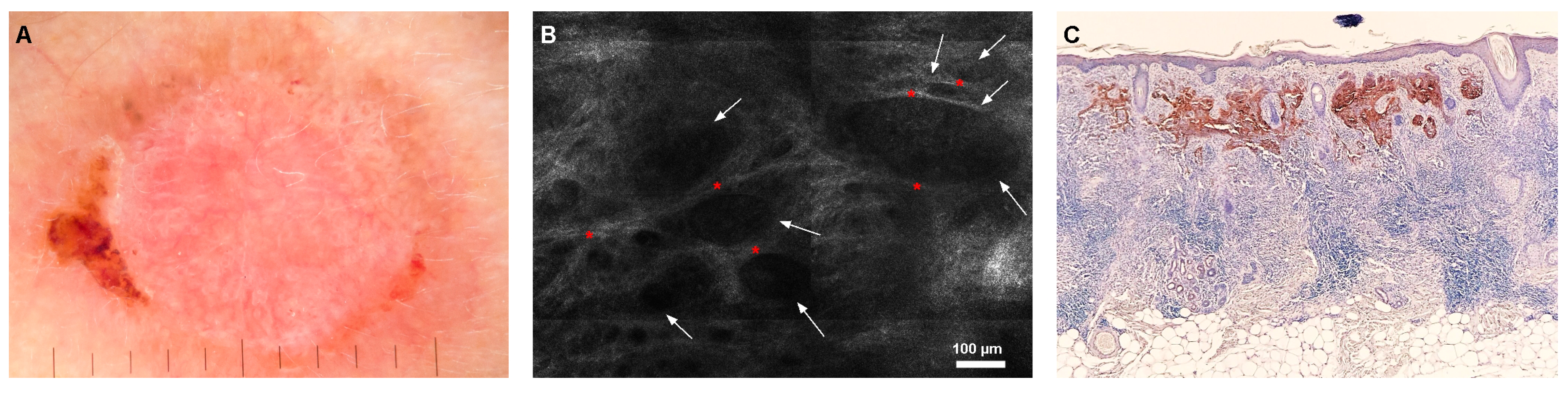 Jcm 08 00449 g004 Jcm 08 00449 g004