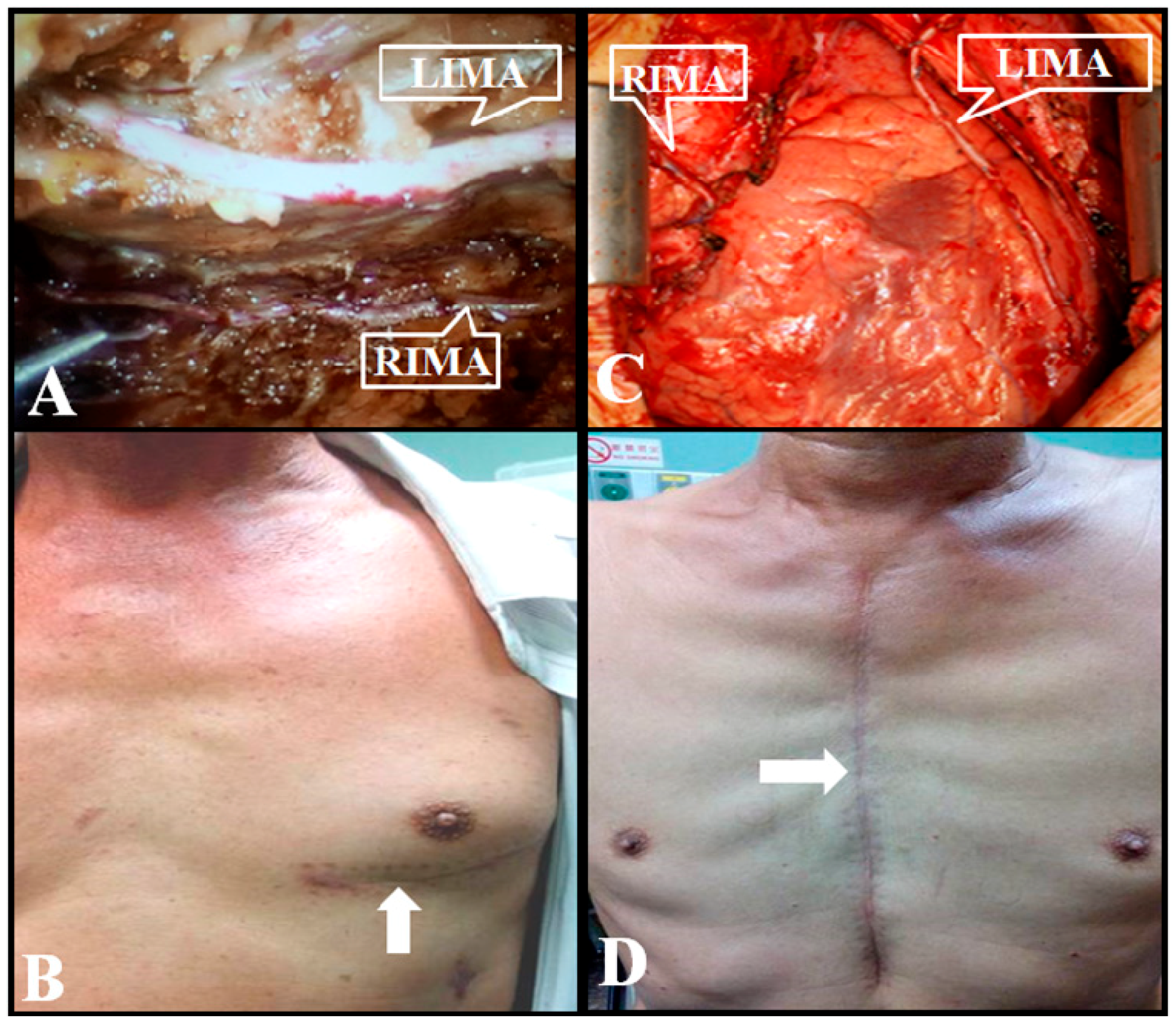 Jcm 08 00502 g002 Jcm 08 00502 g002