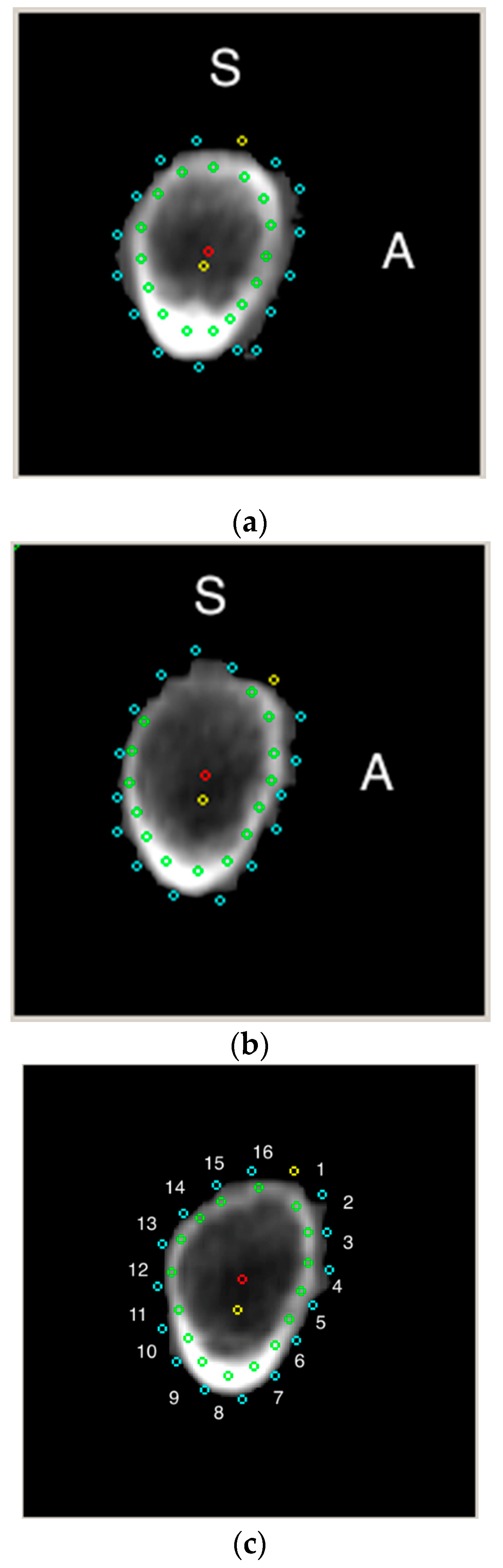 Jcm 08 00669 g003 Jcm 08 00669 g003
