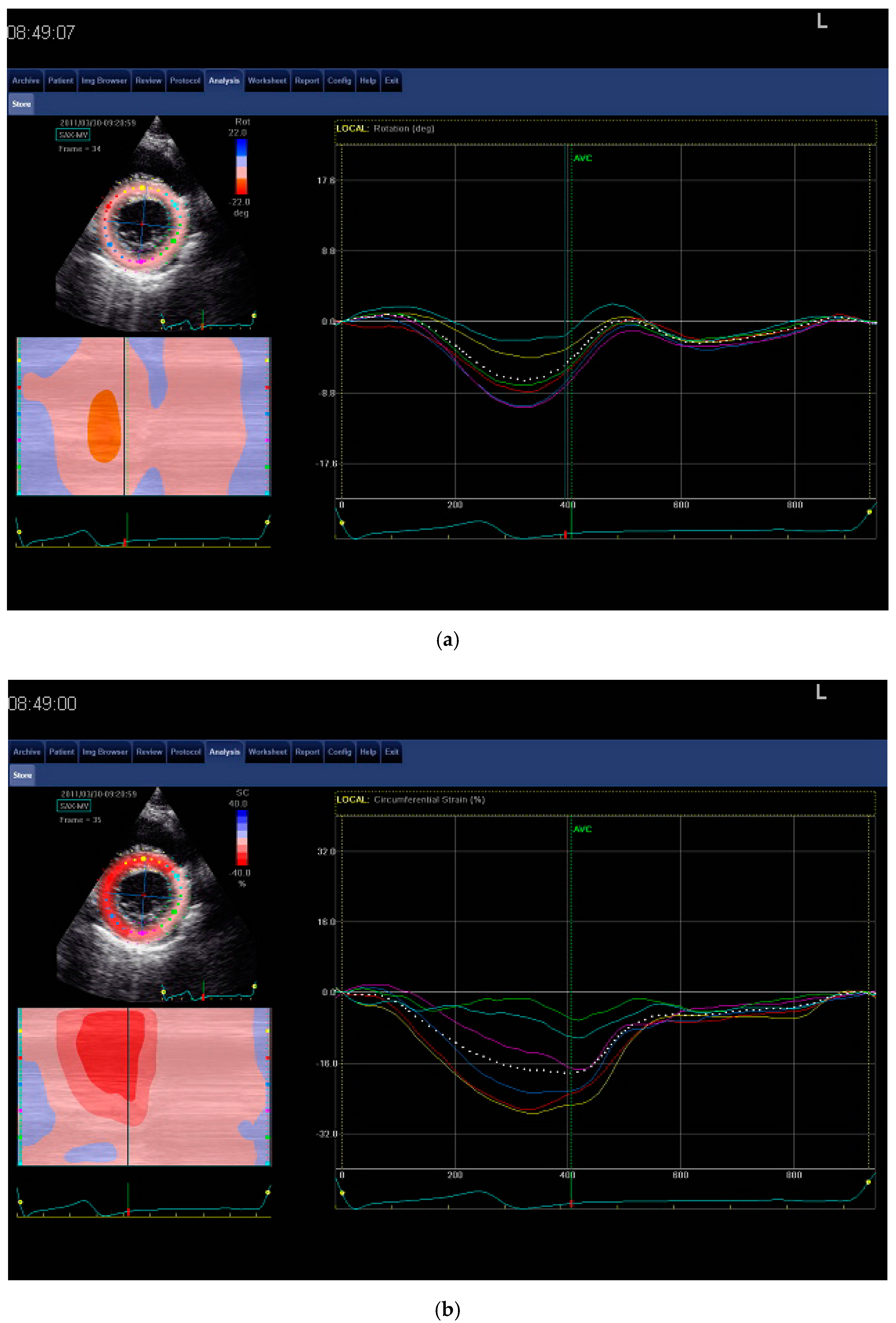 Jcm 08 00687 g001a Jcm 08 00687 g001a