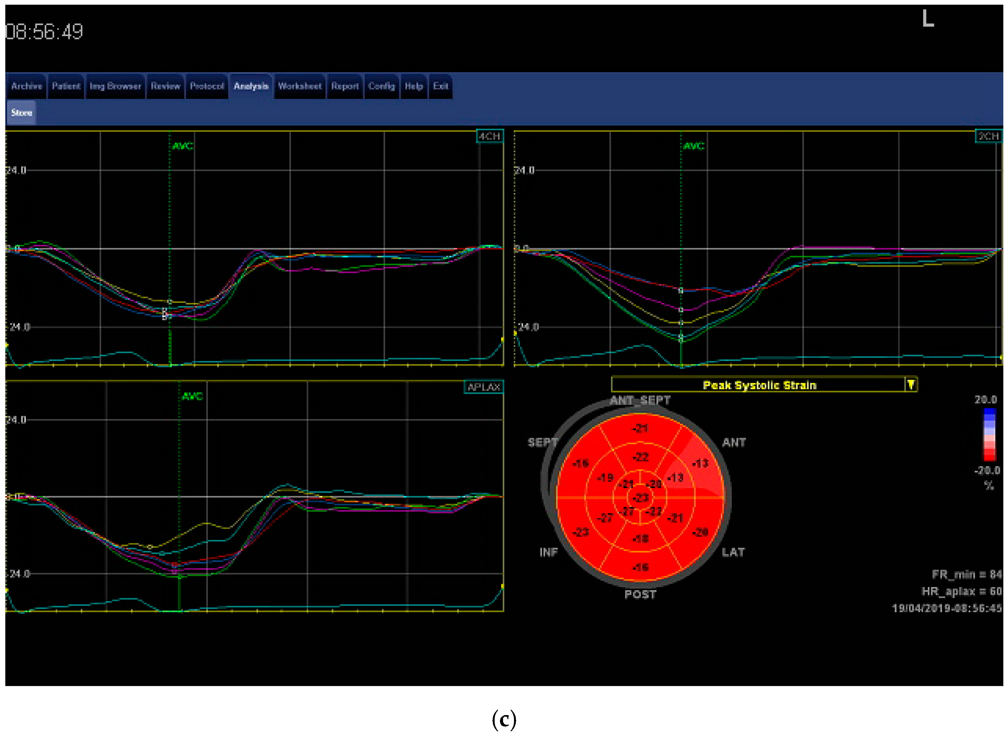 Jcm 08 00687 g001b Jcm 08 00687 g001b