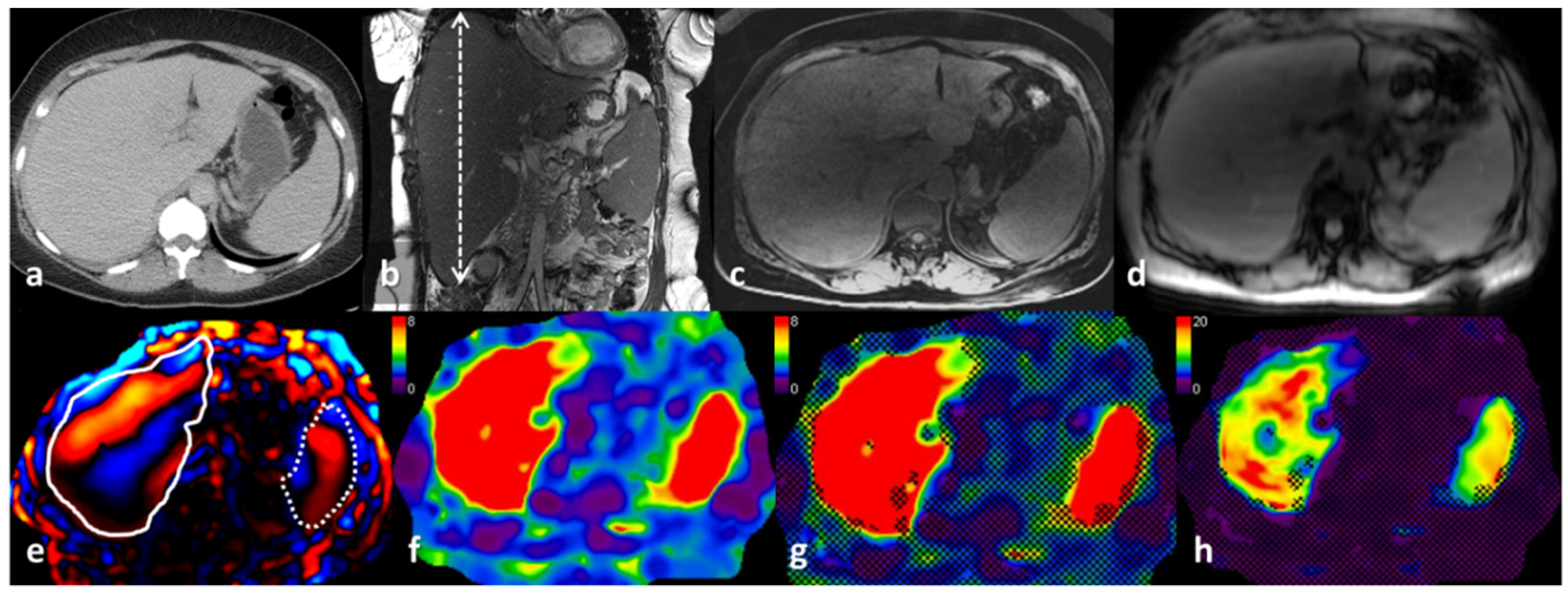 Jcm 08 00739 g002 Jcm 08 00739 g002