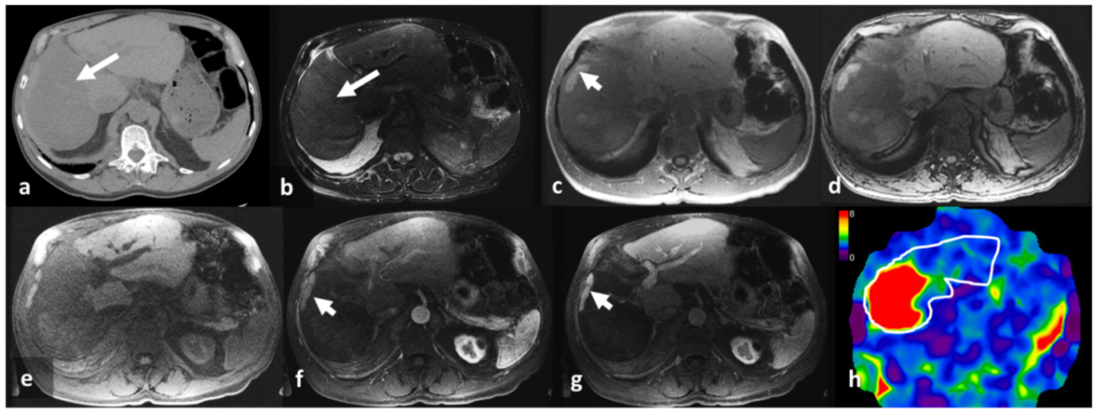 Jcm 08 00739 g003 Jcm 08 00739 g003