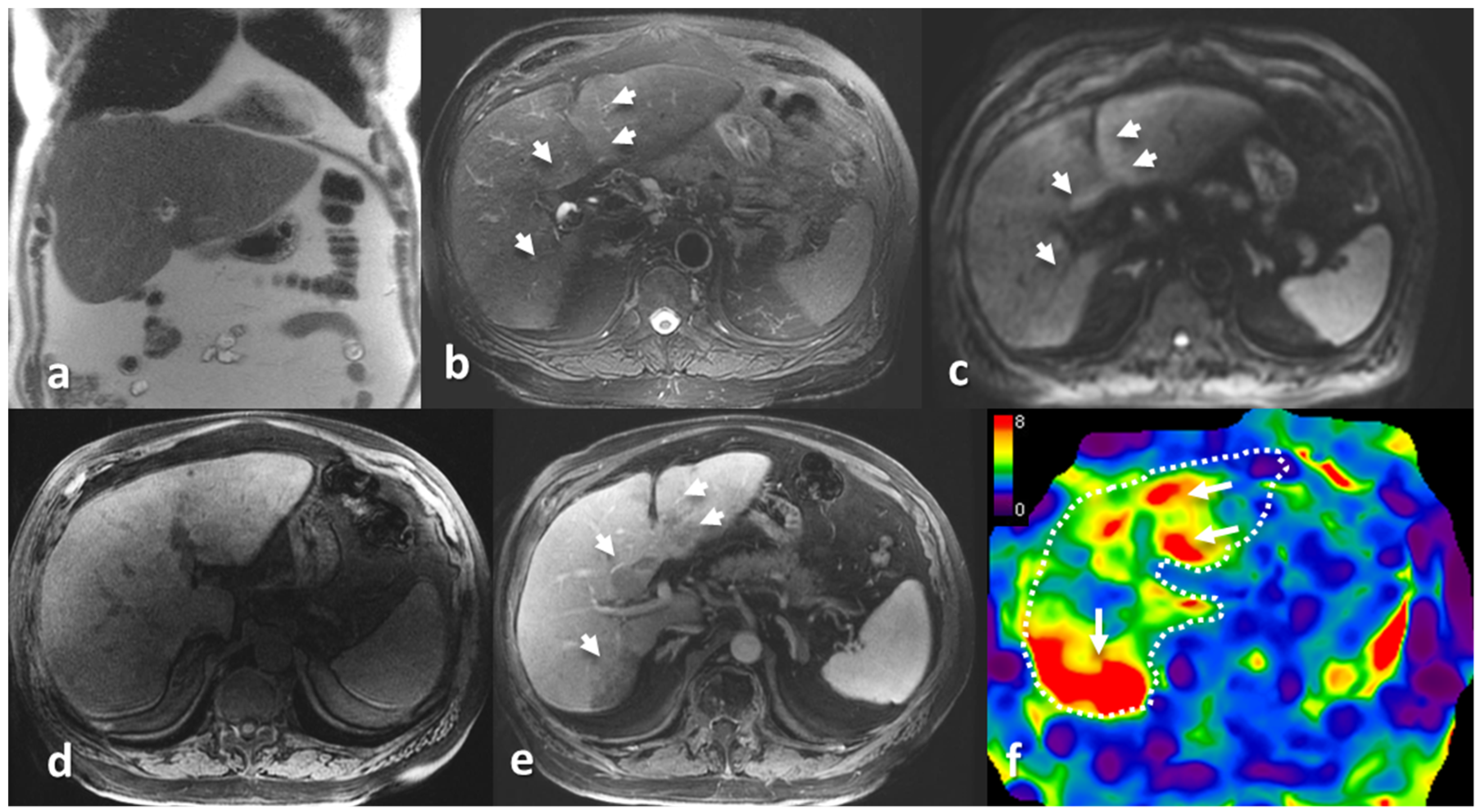 Jcm 08 00739 g004 Jcm 08 00739 g004