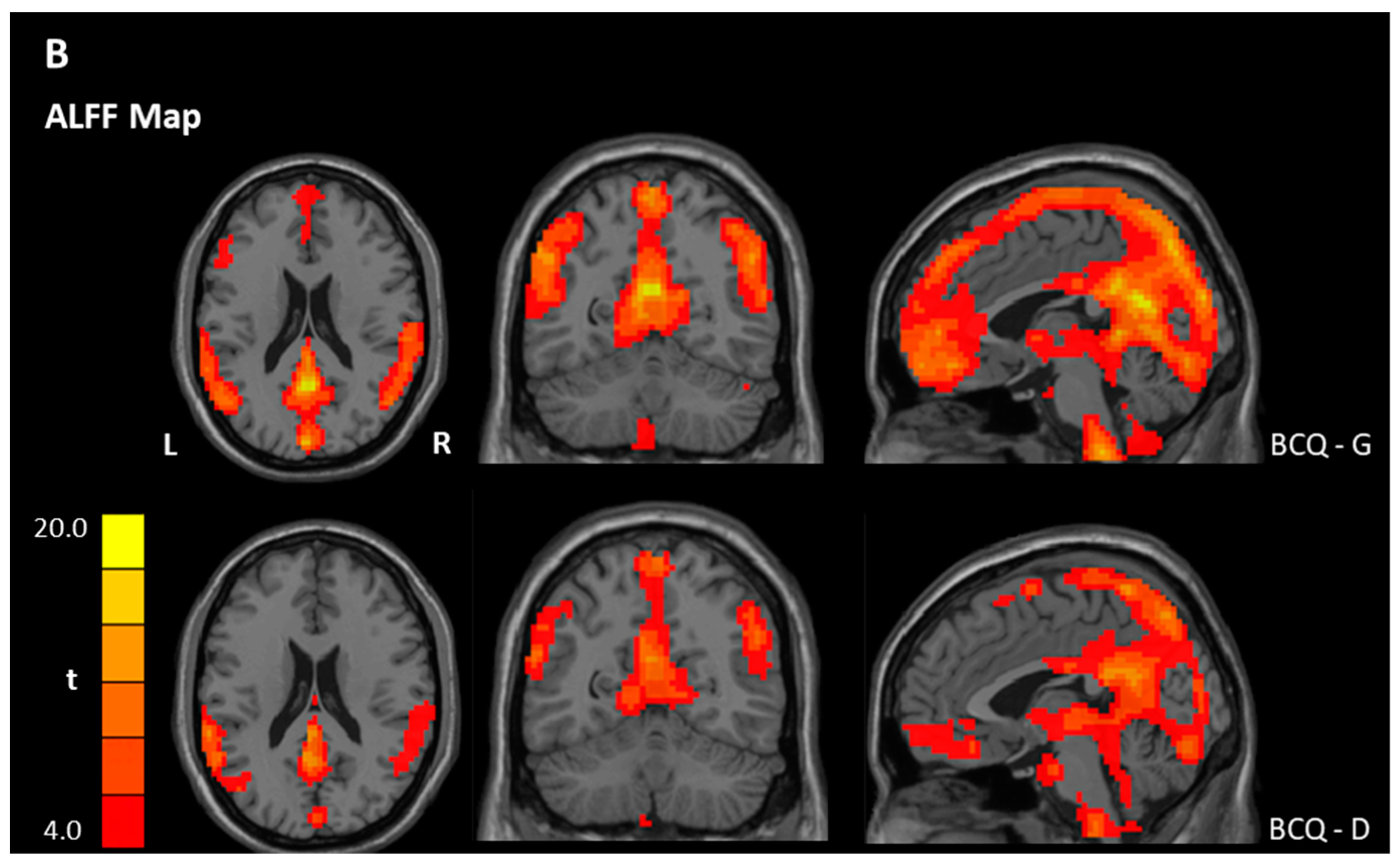 Jcm 08 00951 g001b Jcm 08 00951 g001b