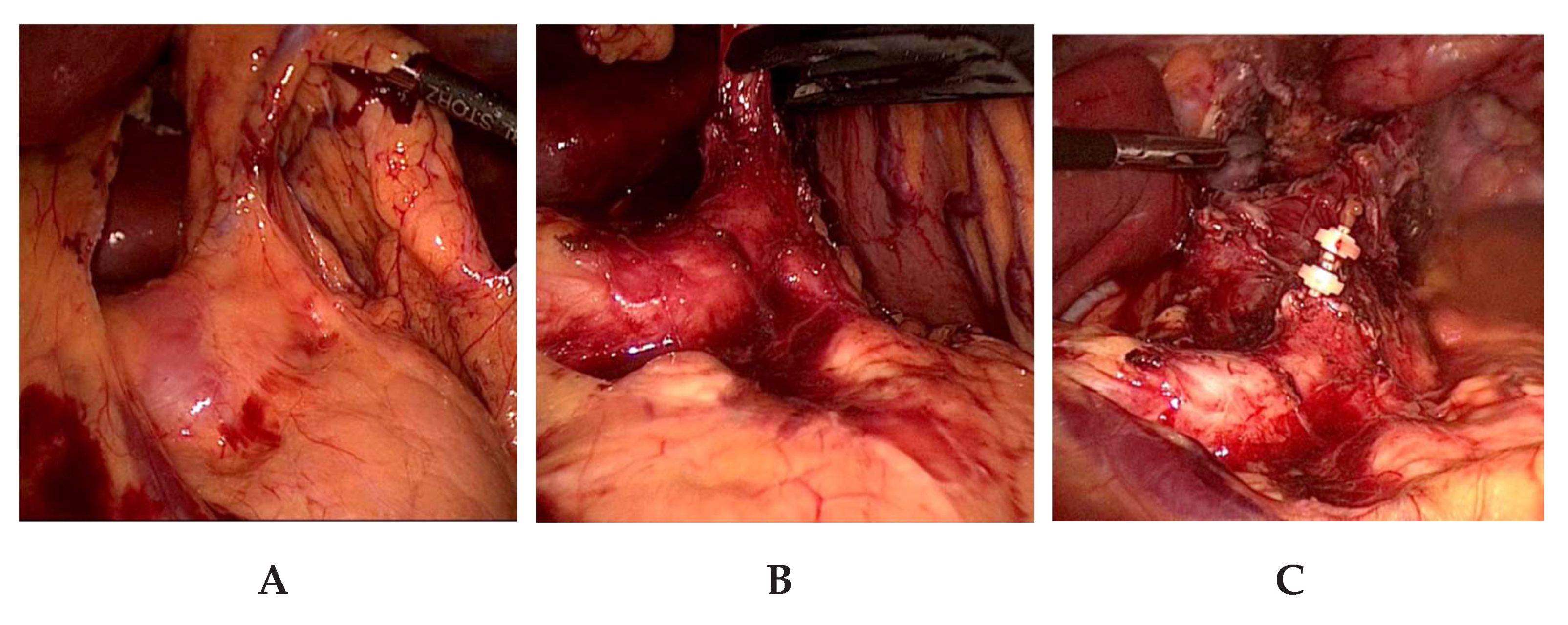 Jcm 08 00978 g003 550