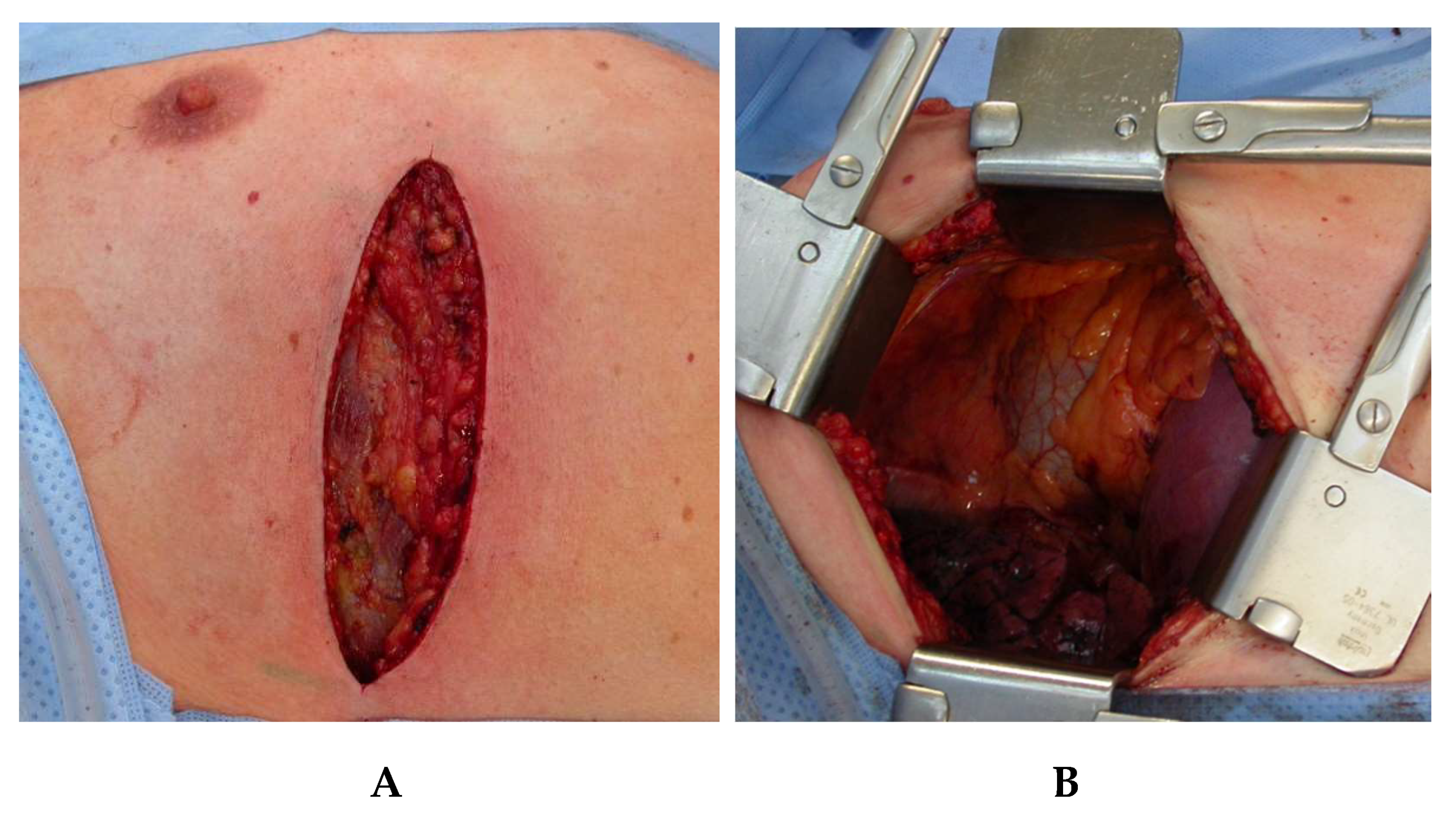 Jcm 08 00978 g004 550