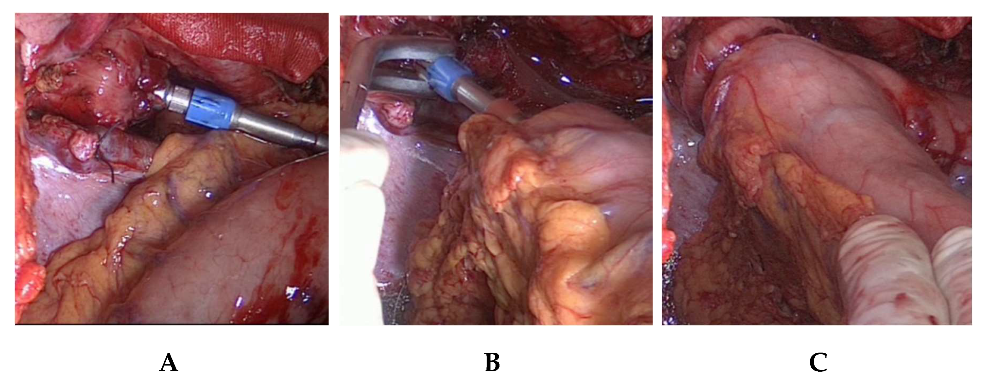 Jcm 08 00978 g005 550