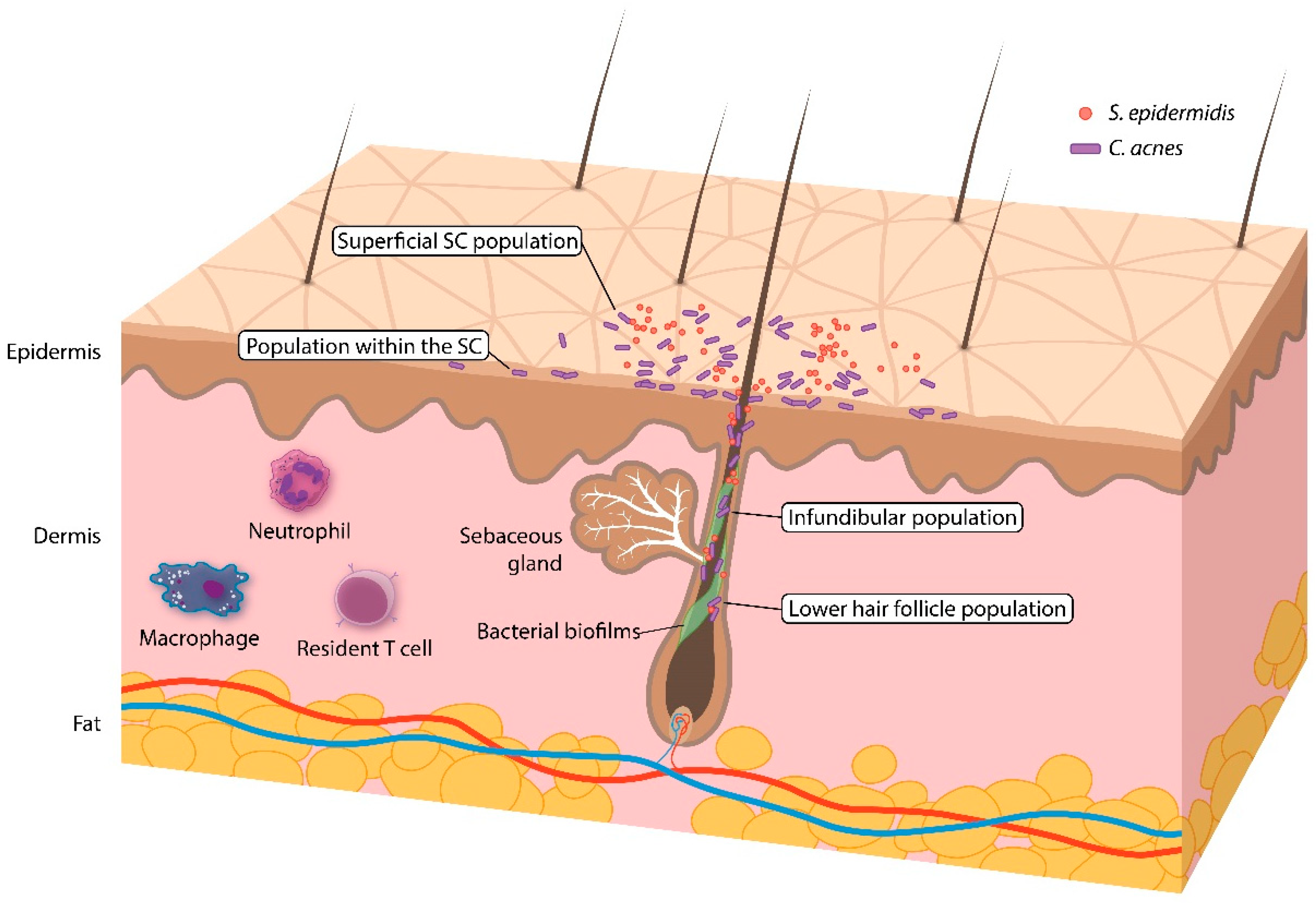 JCM  Free Full-Text  Potential Role of the Microbiome in Acne: A Comprehensive Review