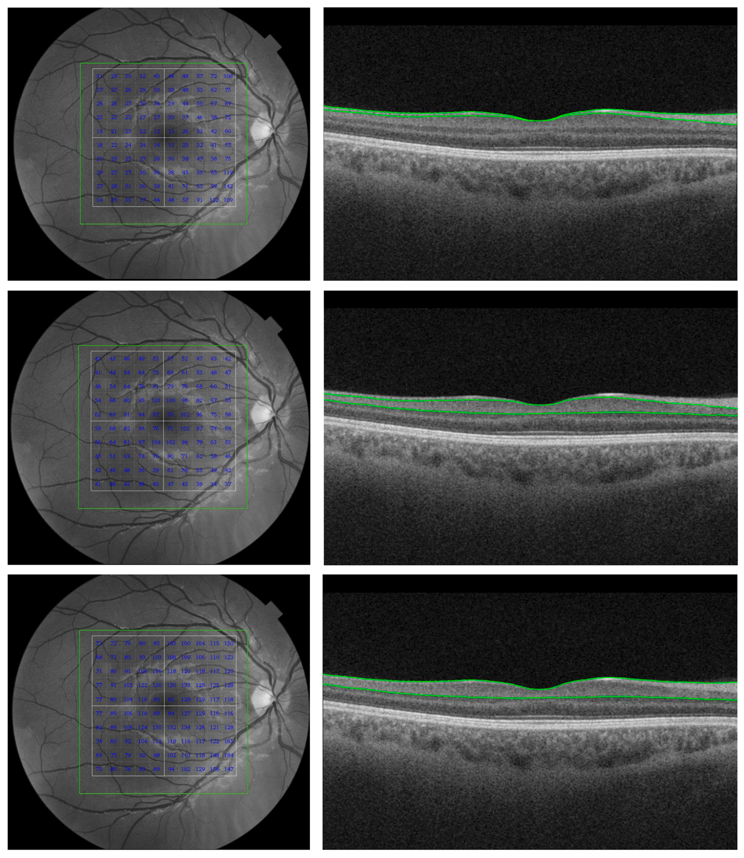 Jcm 08 00996 g002 Jcm 08 00996 g002