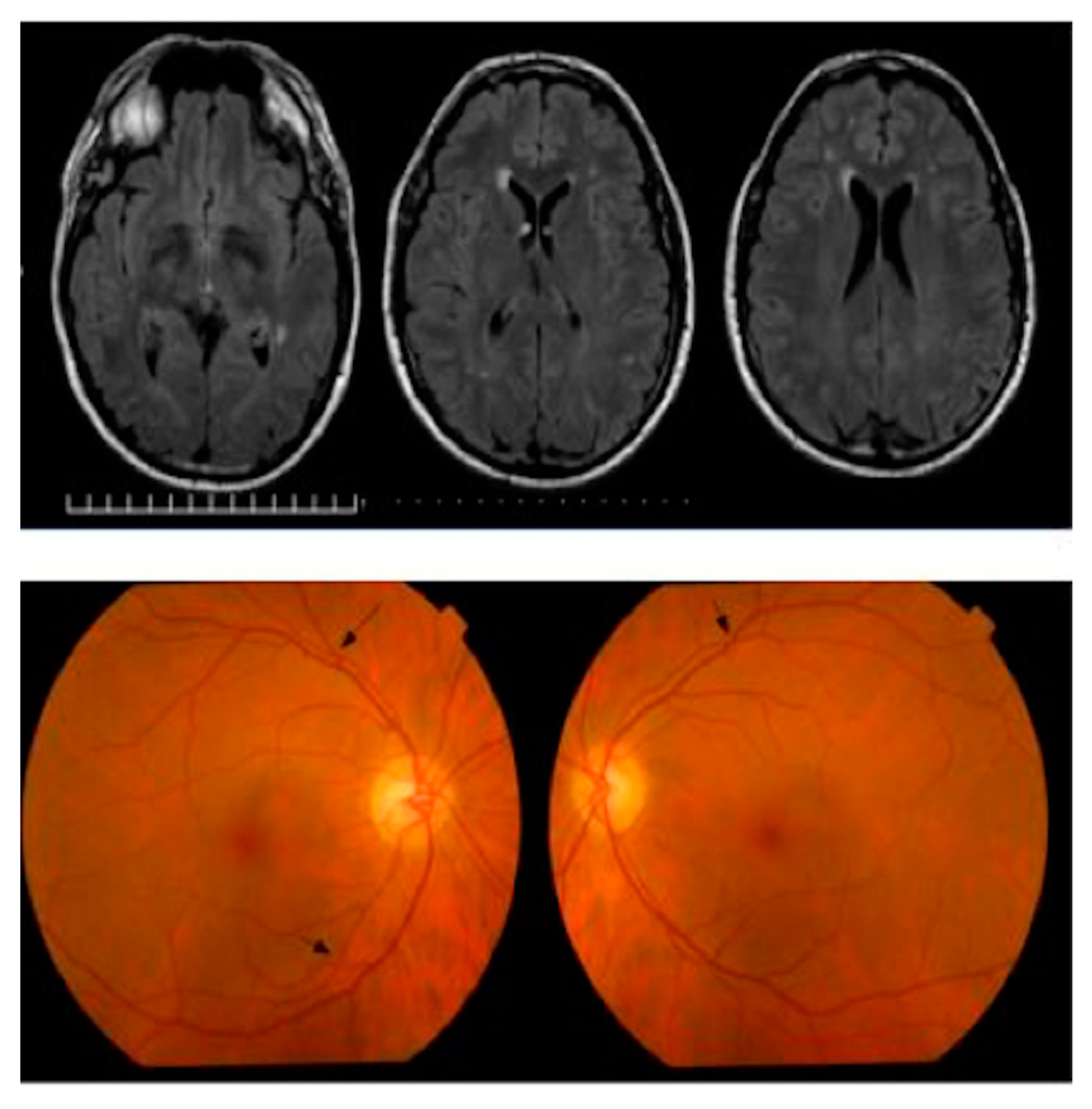 Jcm 08 00996 g005 Jcm 08 00996 g005