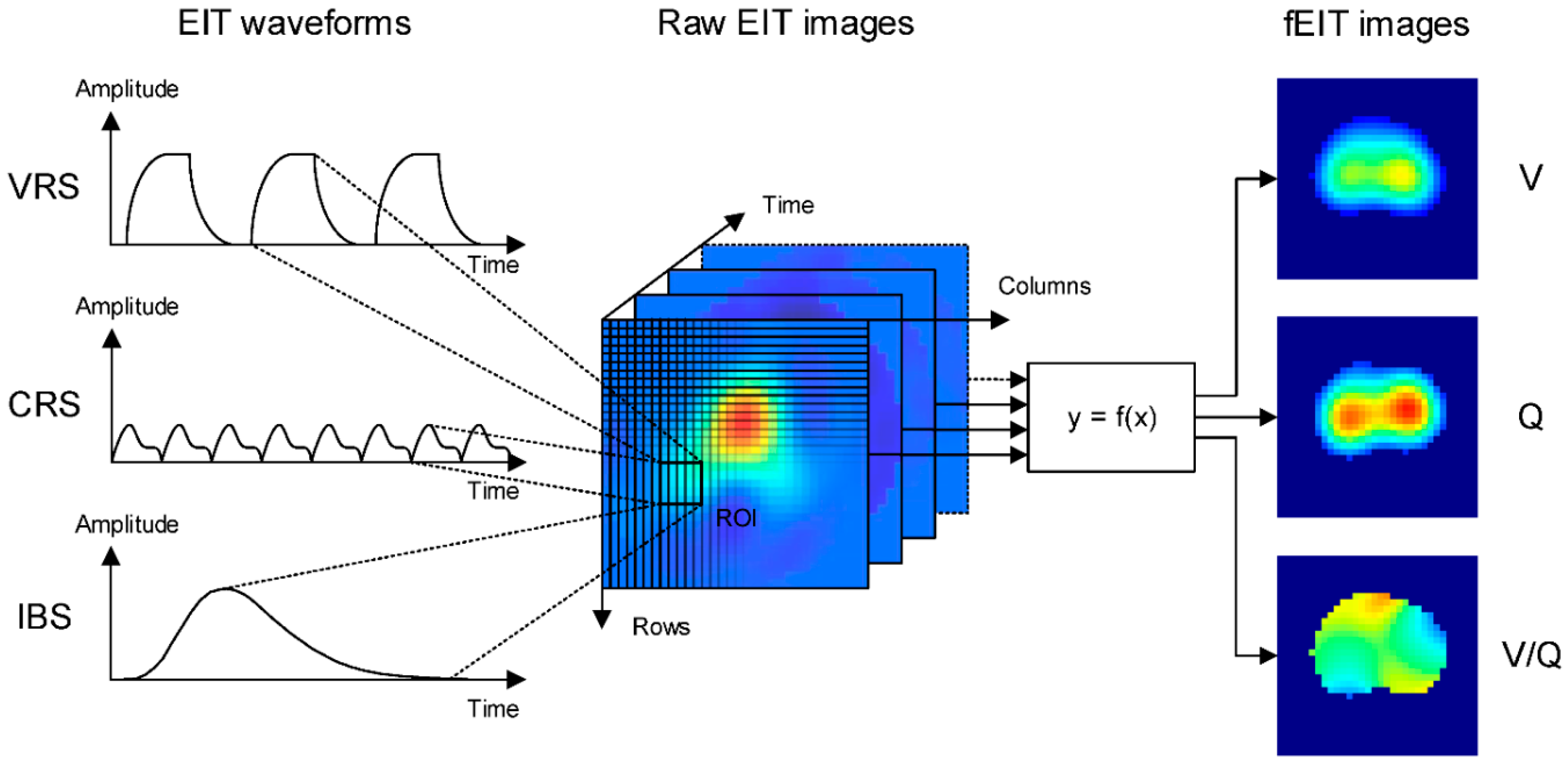 JCM Free FullText Electrical Impedance Tomography for Cardio