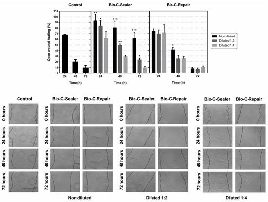Jcm Free Full Text Biological Effects Of New Hydraulic Materials On Human Periodontal Ligament Stem Cells Html Jcm Free Full Text Biological Effects Of New Hydraulic Materials On Human Periodontal Ligament Stem Cells Html
