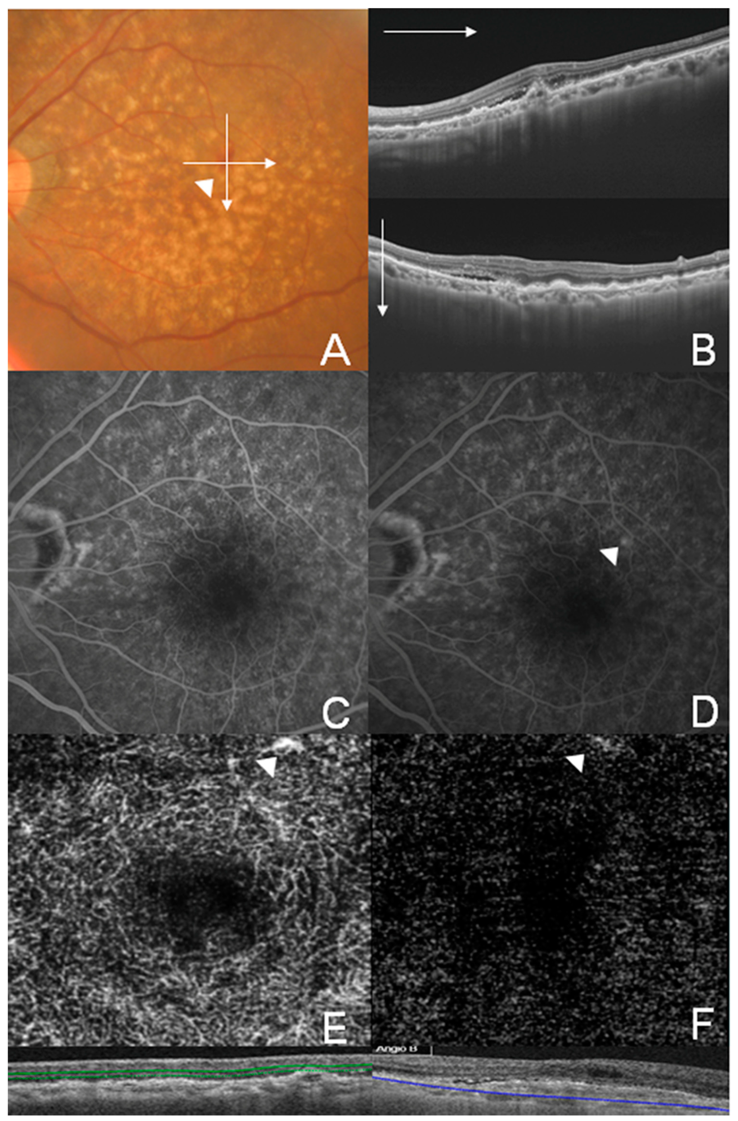 Jcm 08 01272 g005 Jcm 08 01272 g005