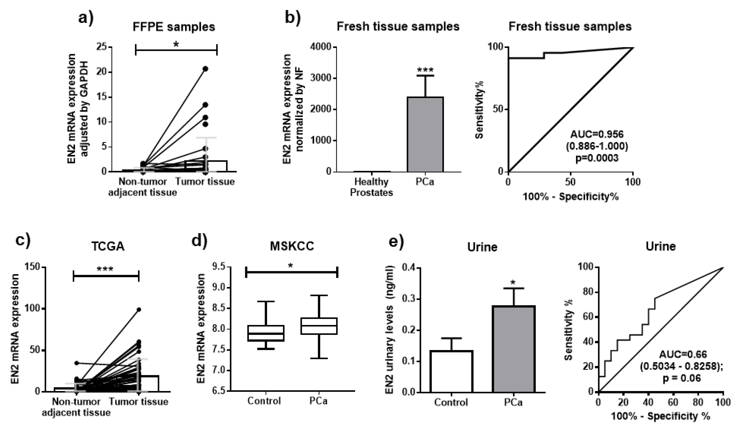 Jcm Free Full Text Oncogenic Role Of Secreted Engrailed Homeobox 2 En2 In Prostate Cancer Html