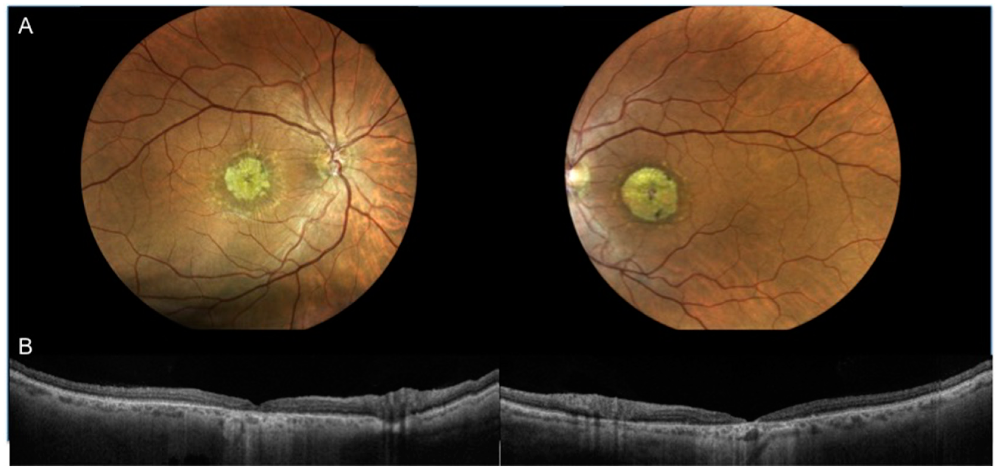 Jcm 08 01432 g003 Jcm 08 01432 g003