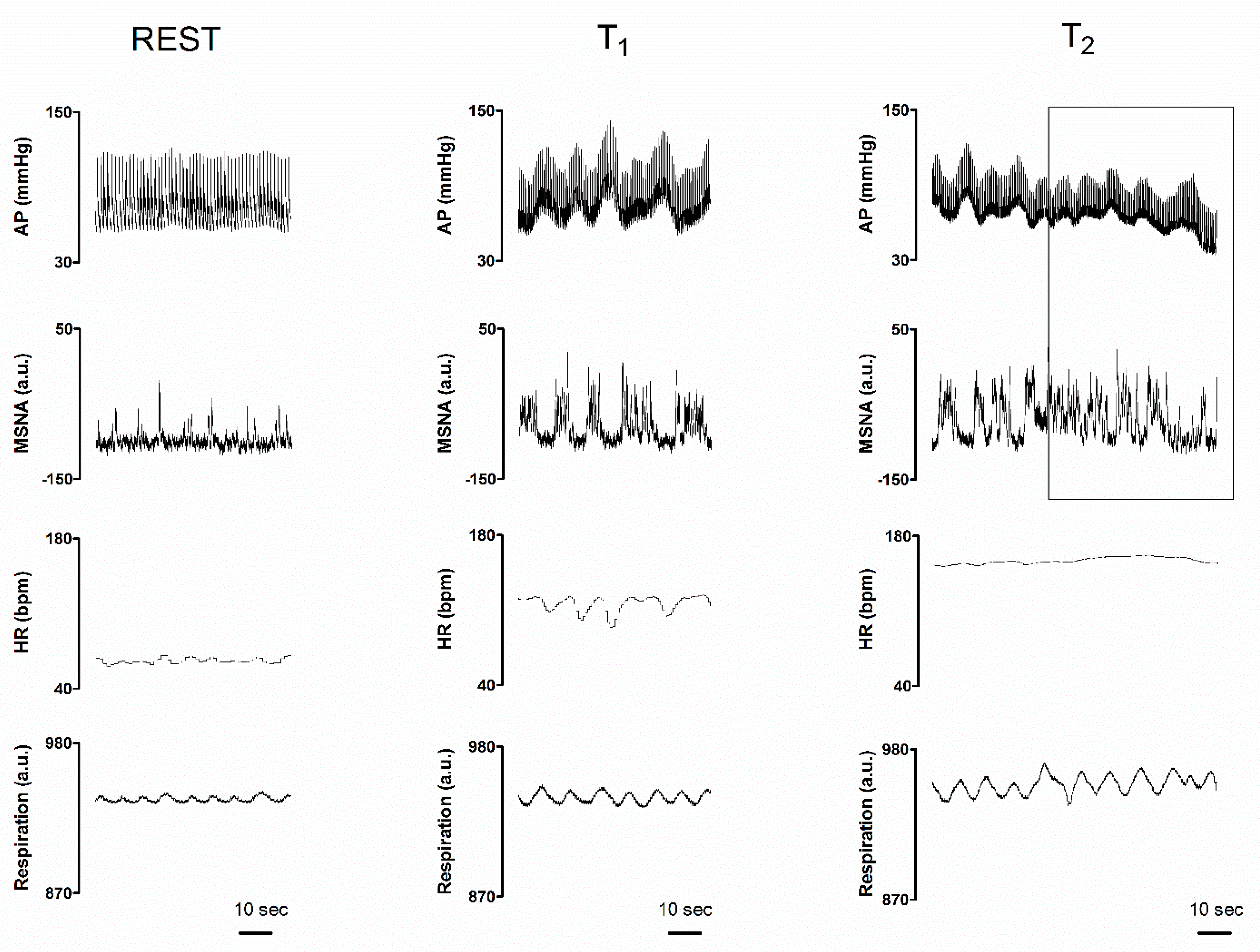Jcm Free Full Text Cardiac And Vascular Sympathetic Baroreflex Control During Orthostatic Pre Syncope Html Jcm Free Full Text Cardiac And Vascular Sympathetic Baroreflex Control During Orthostatic Pre Syncope Html