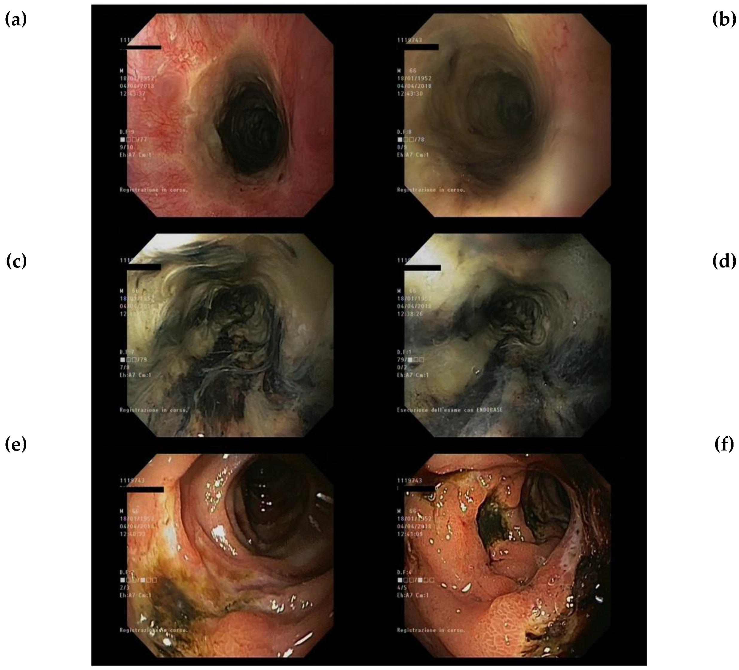 Jcm 08 01532 g003 Jcm 08 01532 g003