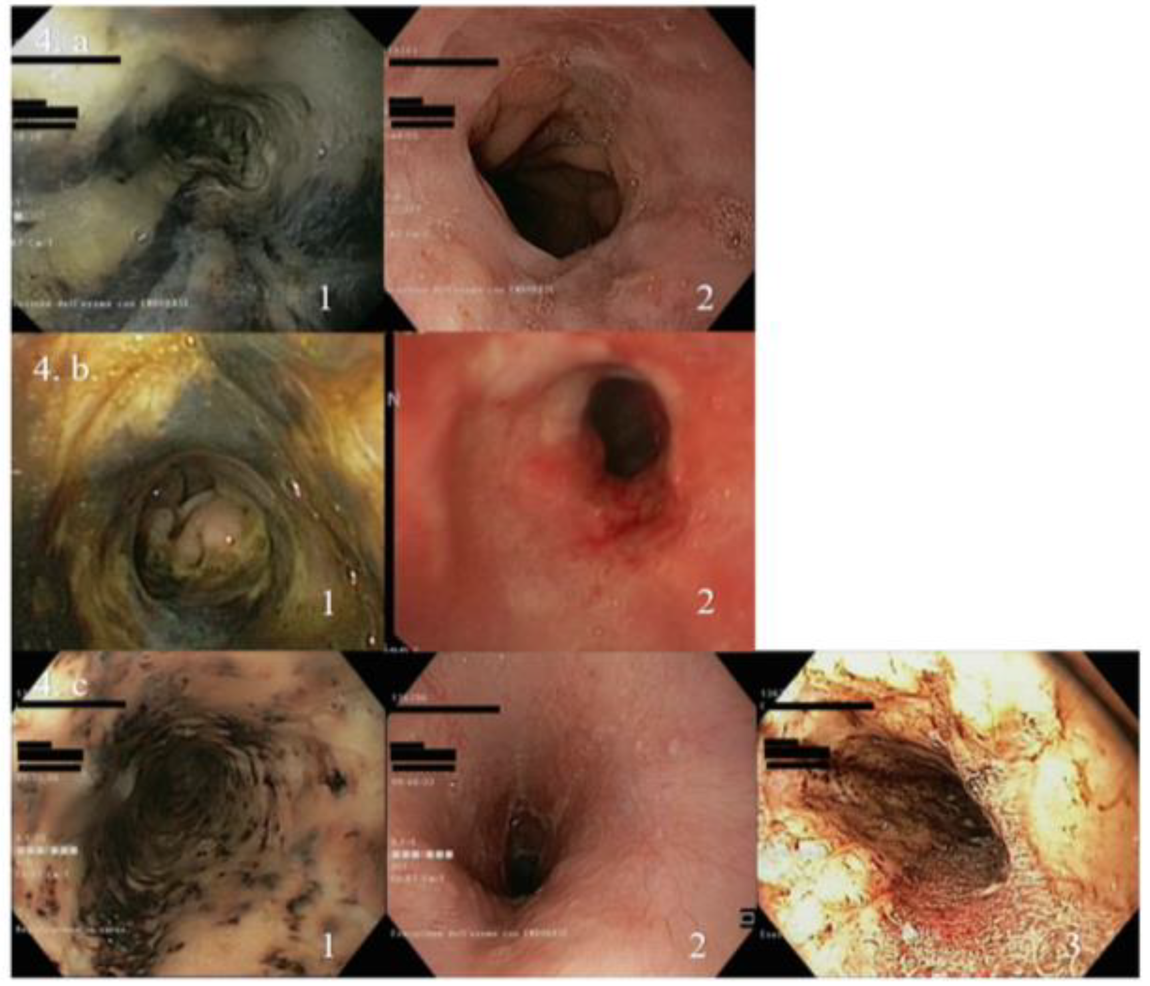 Jcm 08 01532 g004 Jcm 08 01532 g004