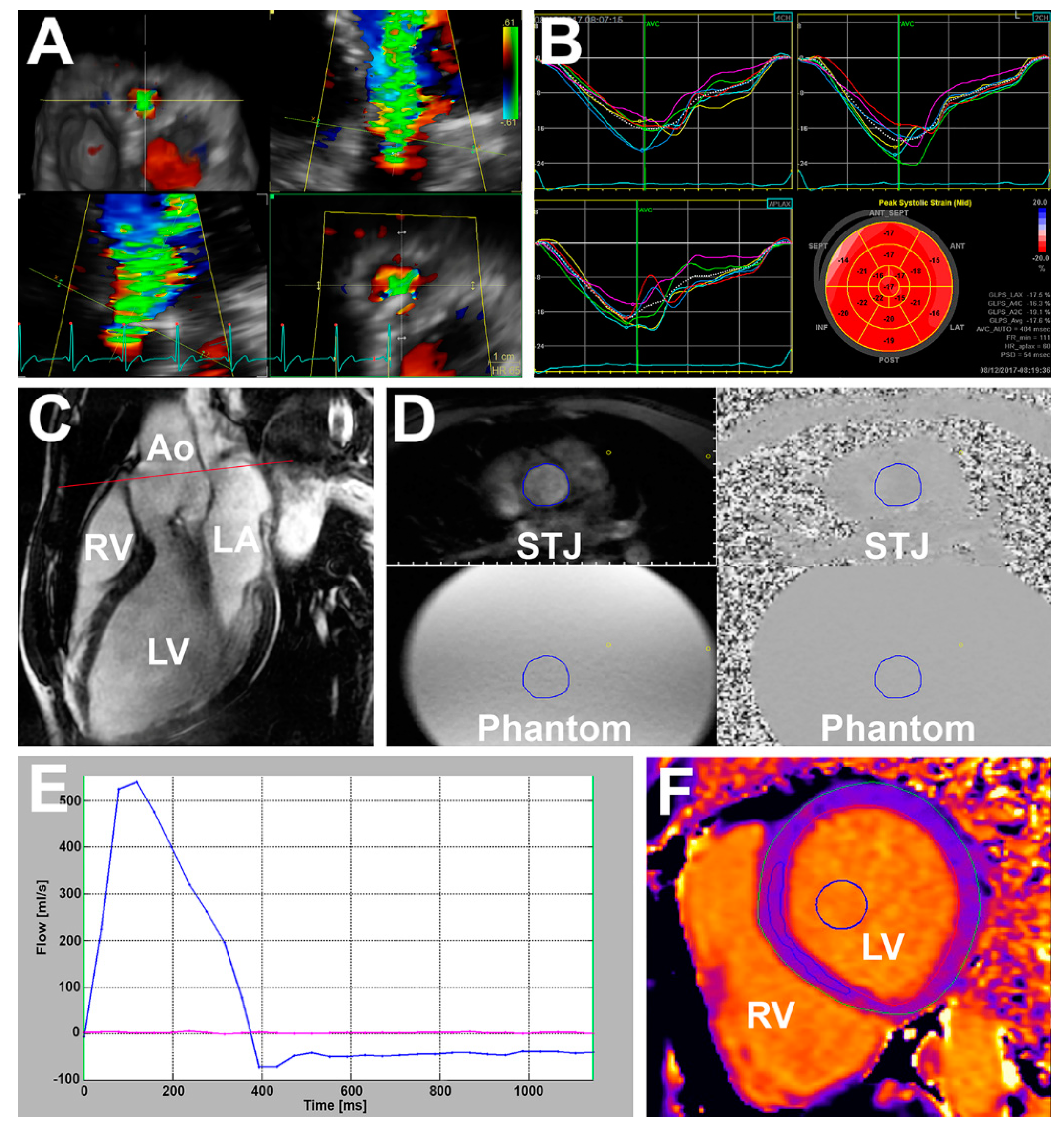 Jcm 08 01654 g001 Jcm 08 01654 g001