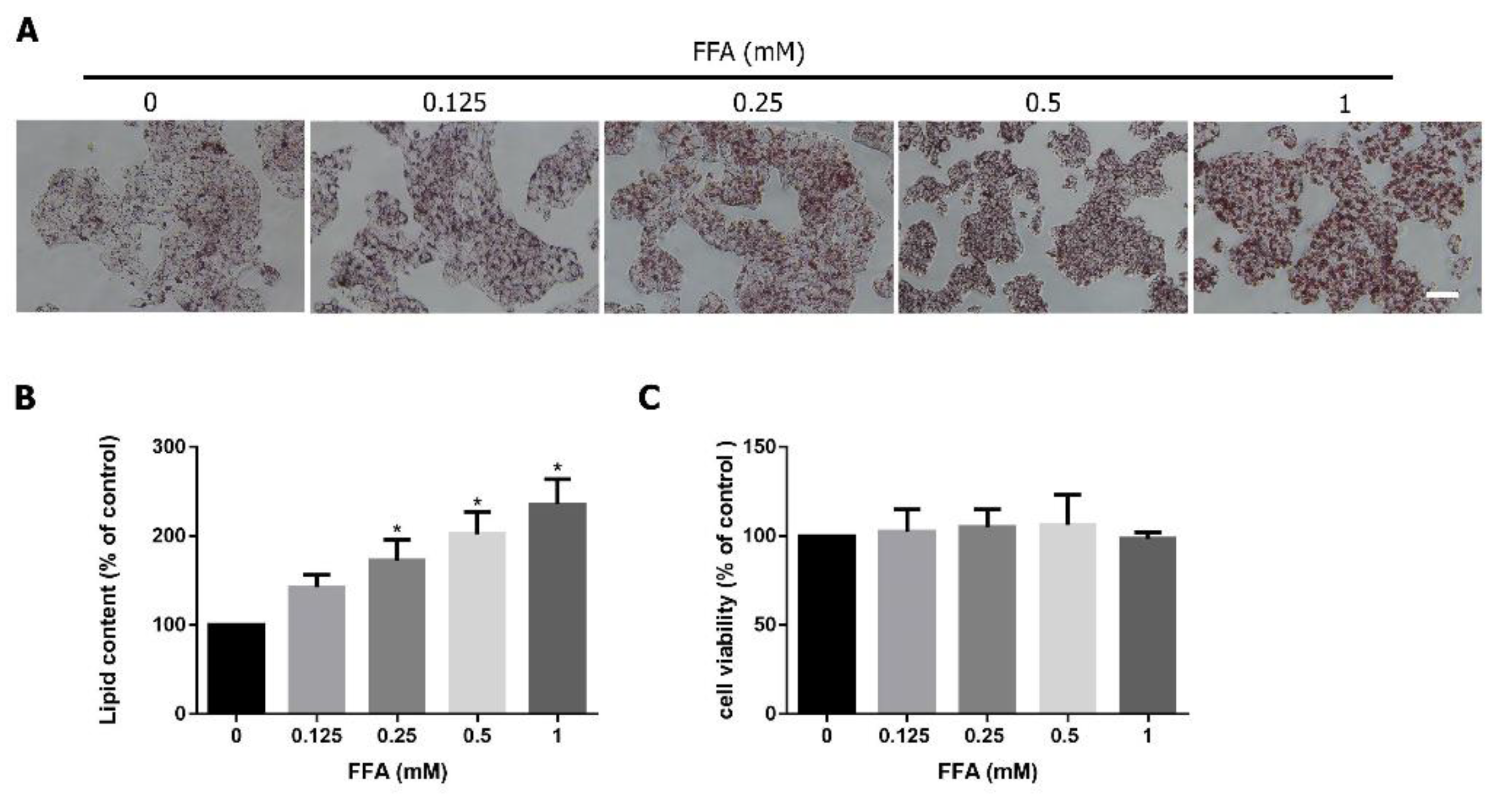 Jcm Free Full Text Polyphenol Rich Extracts From Toona Sinensis Bark And Fruit Ameliorate Free Fatty Acid Induced Lipogenesis Through Ampk And Lc3 Pathways Html