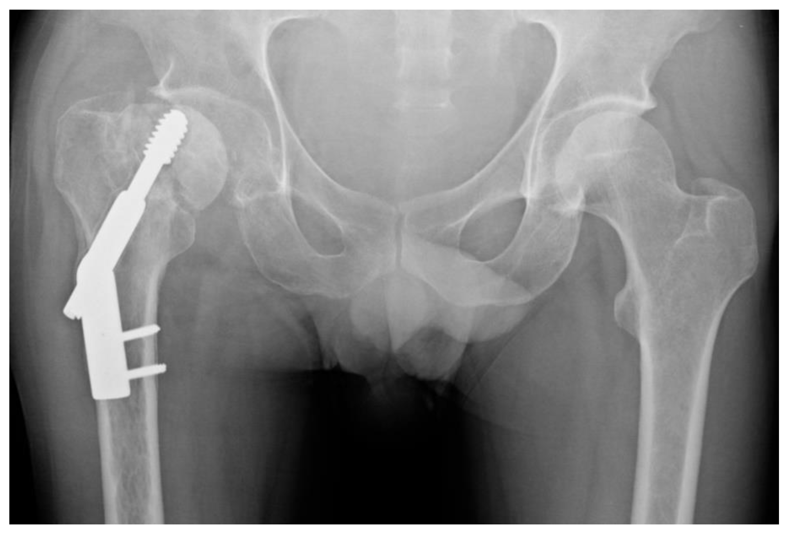 Jcm 08 01670 g005 Jcm 08 01670 g005