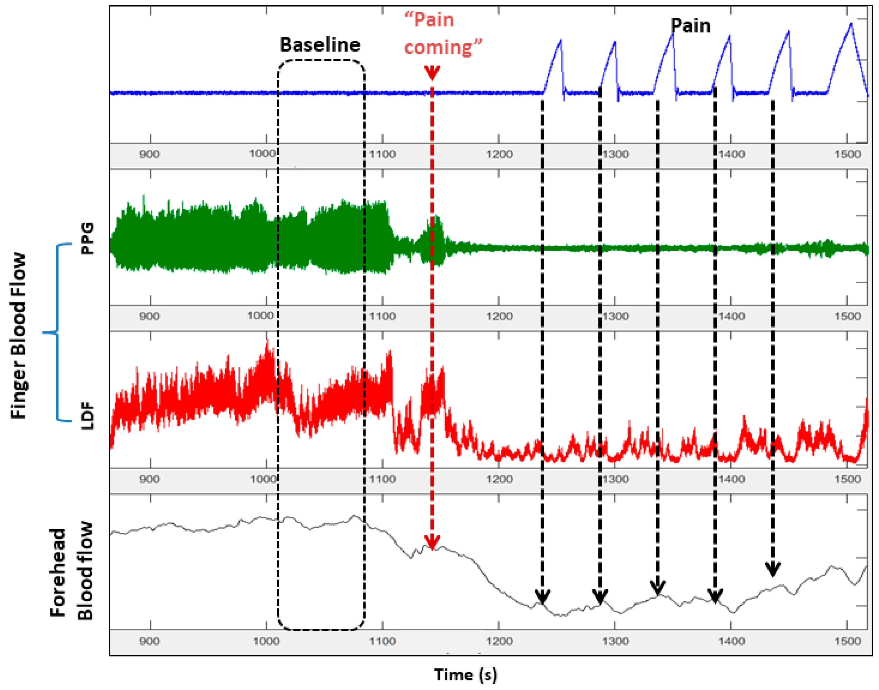 Jcm 08 01690 g006 Jcm 08 01690 g006