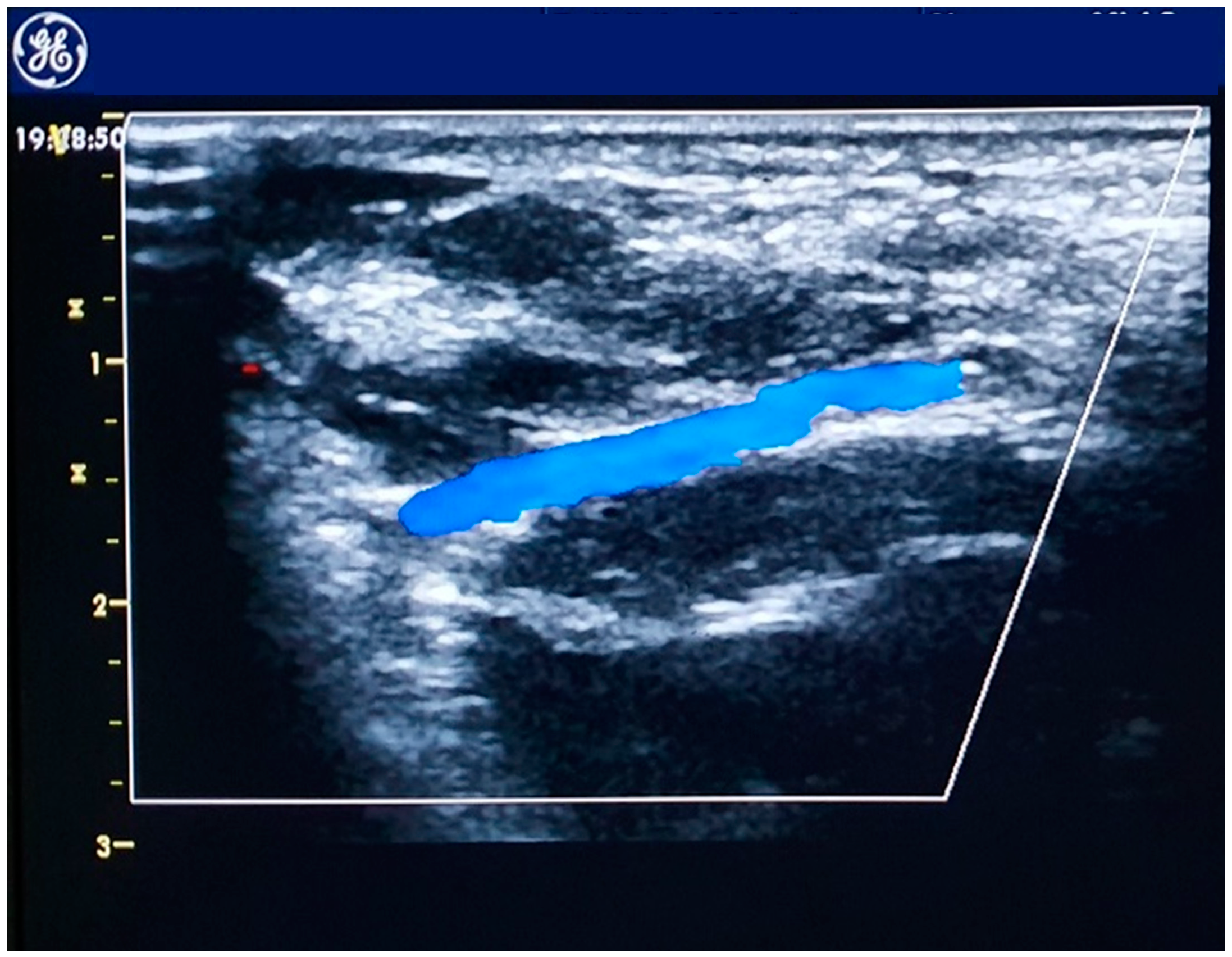 Jcm 08 01727 g002 Jcm 08 01727 g002