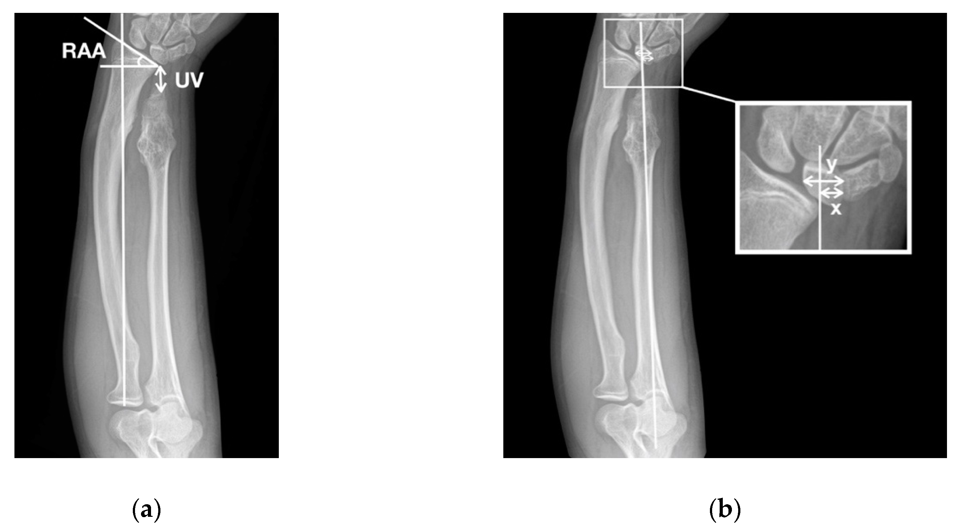 Jcm 08 01765 g002 Jcm 08 01765 g002