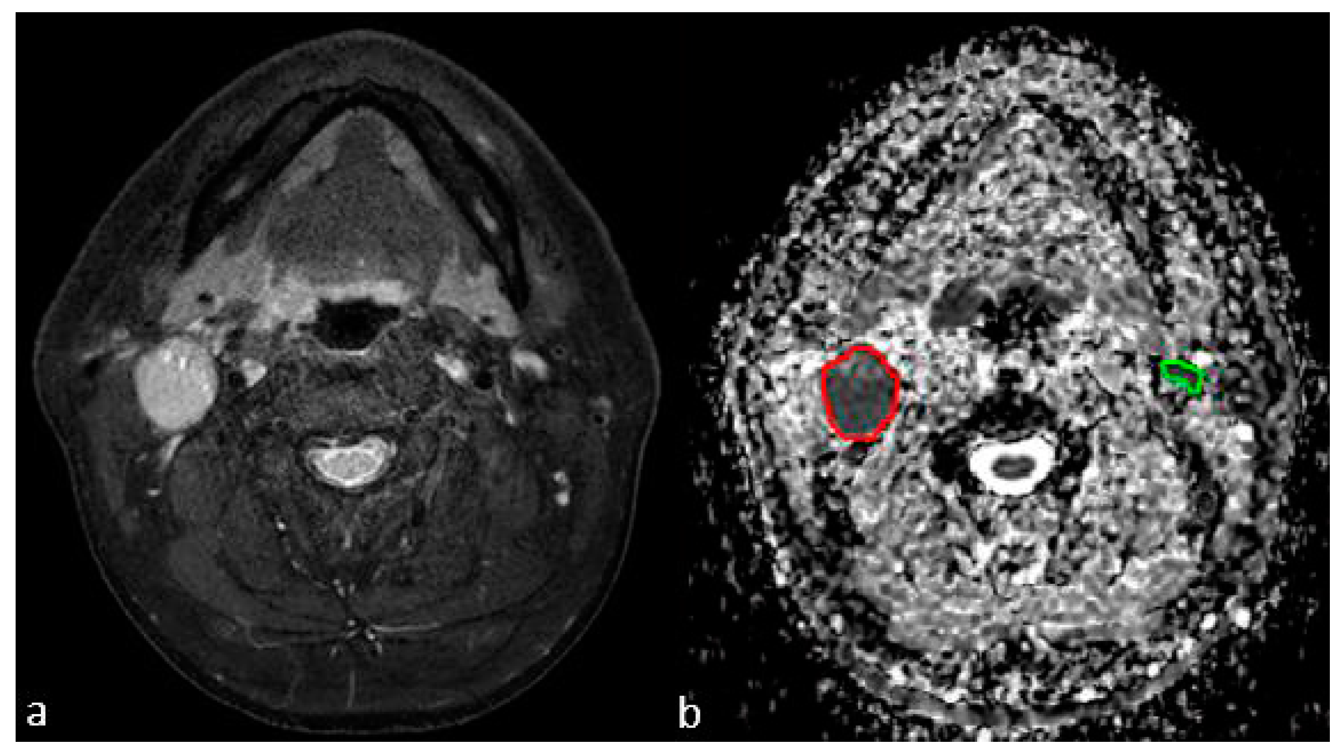 Jcm 08 01767 g002 Jcm 08 01767 g002