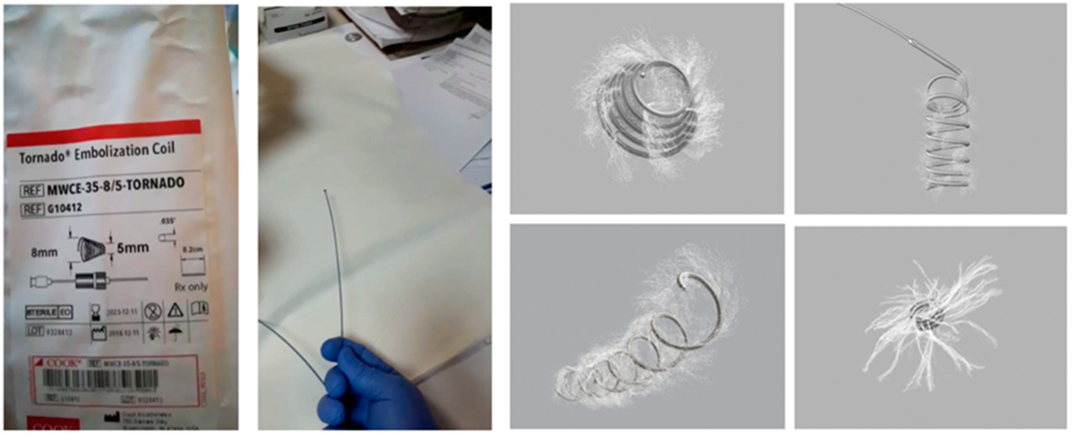 JCM Free FullText Endoscopic UltrasoundGuided Treatment of