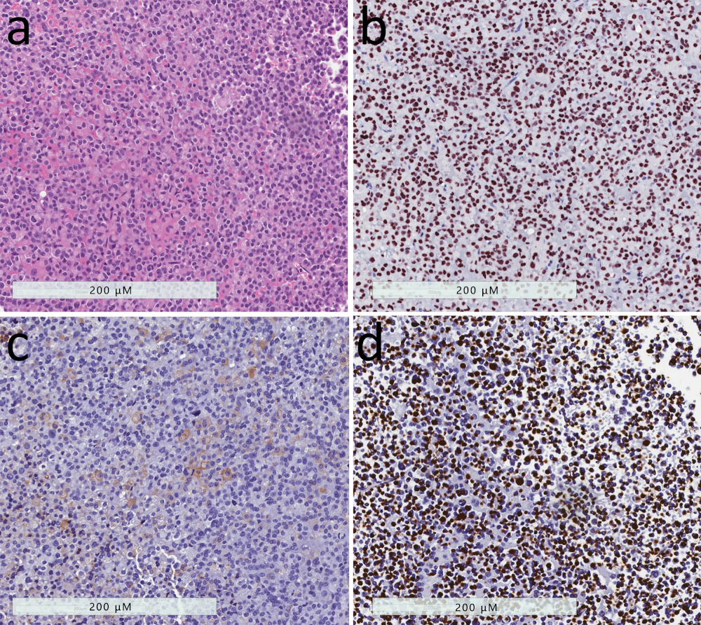 Jcm 08 01962 g003 Jcm 08 01962 g003