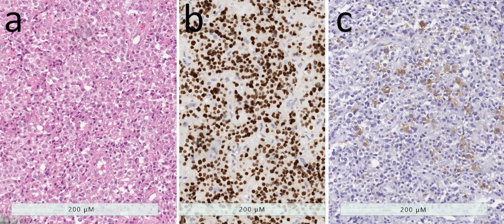 Jcm 08 01962 g005 Jcm 08 01962 g005