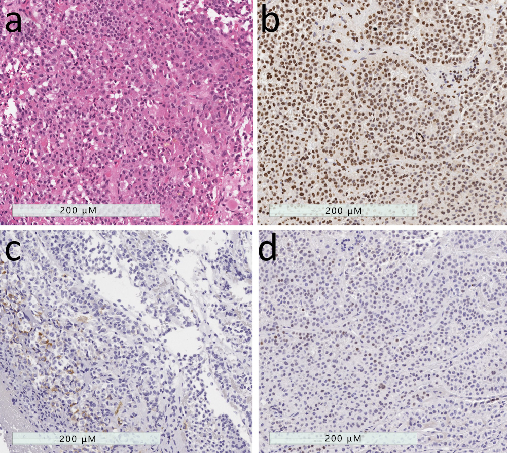 Jcm 08 01962 g006 Jcm 08 01962 g006