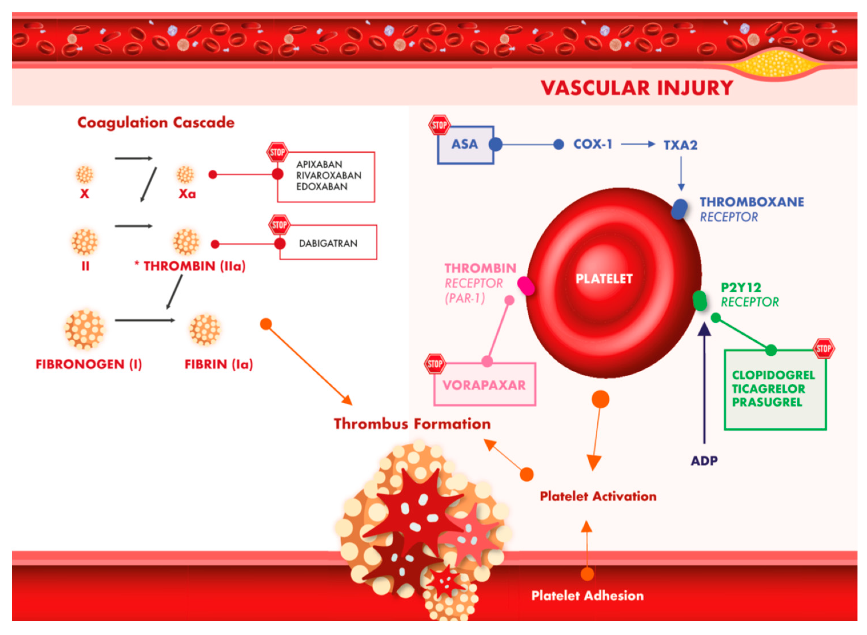 素晴らしい Antithrombotic Therapy for Percutaneous Cardiovascular 医学一般